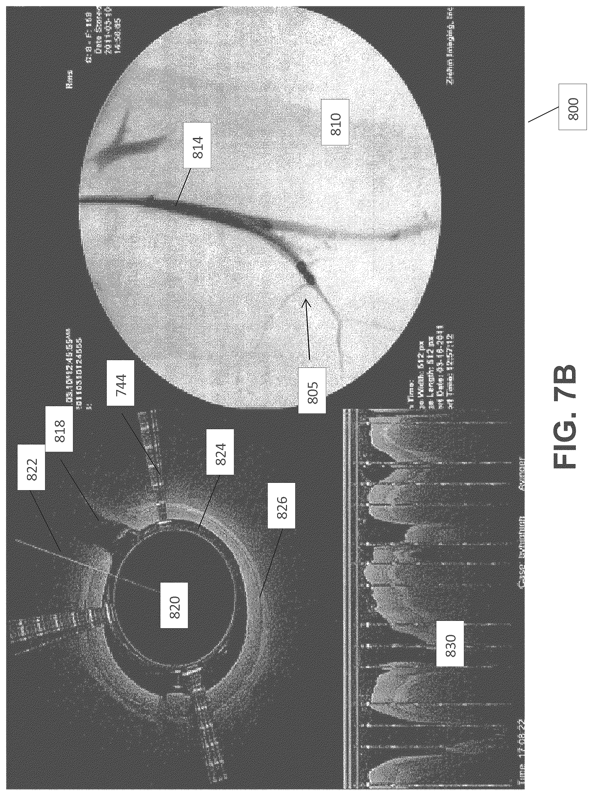 Patent US12137931 Figure 15 – Occlusion-crossing devices