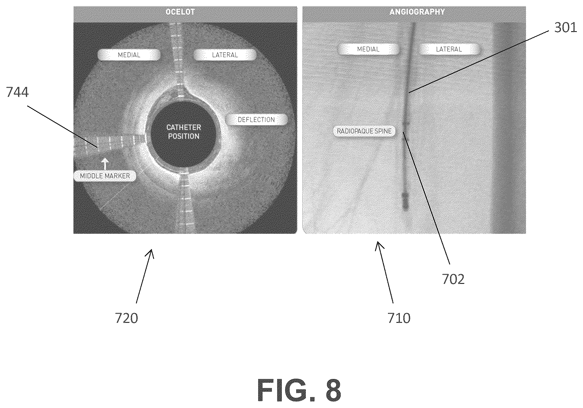 Patent US12137931 Figure 16 – Occlusion-crossing devices