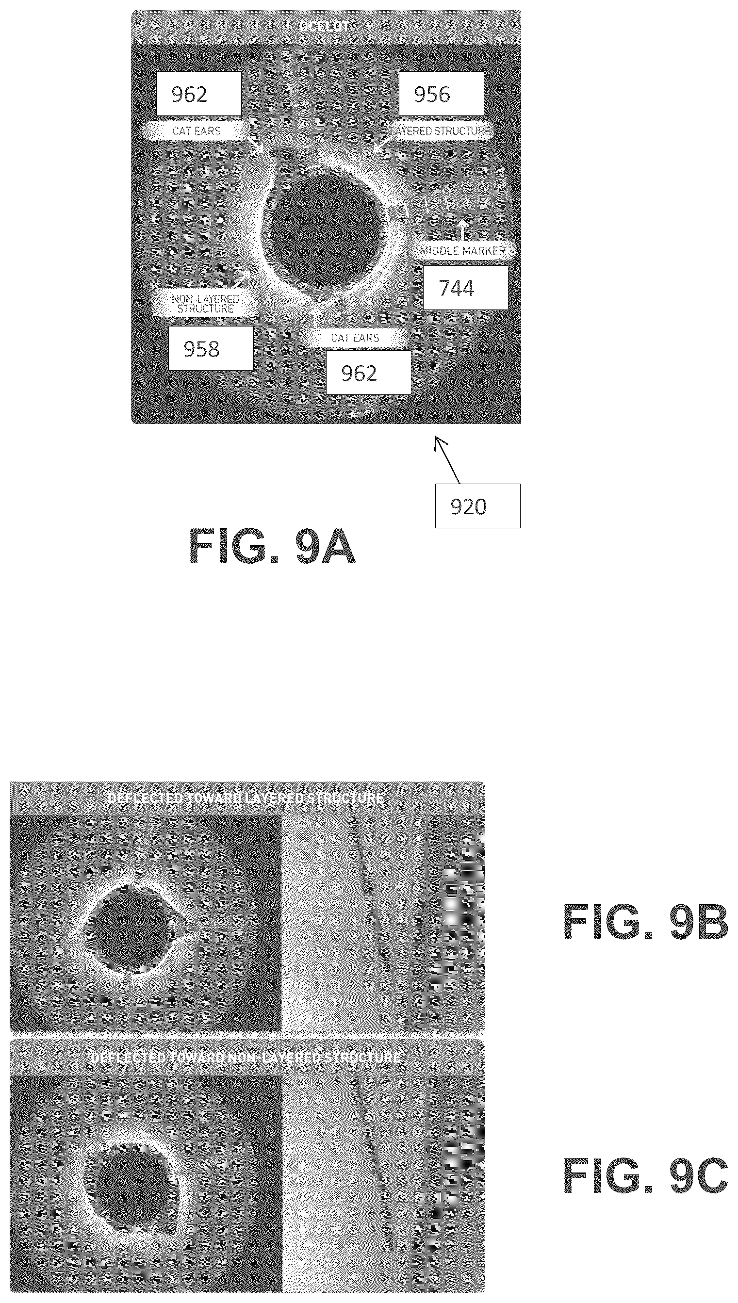 Patent US12137931 Figure 17 – Occlusion-crossing devices