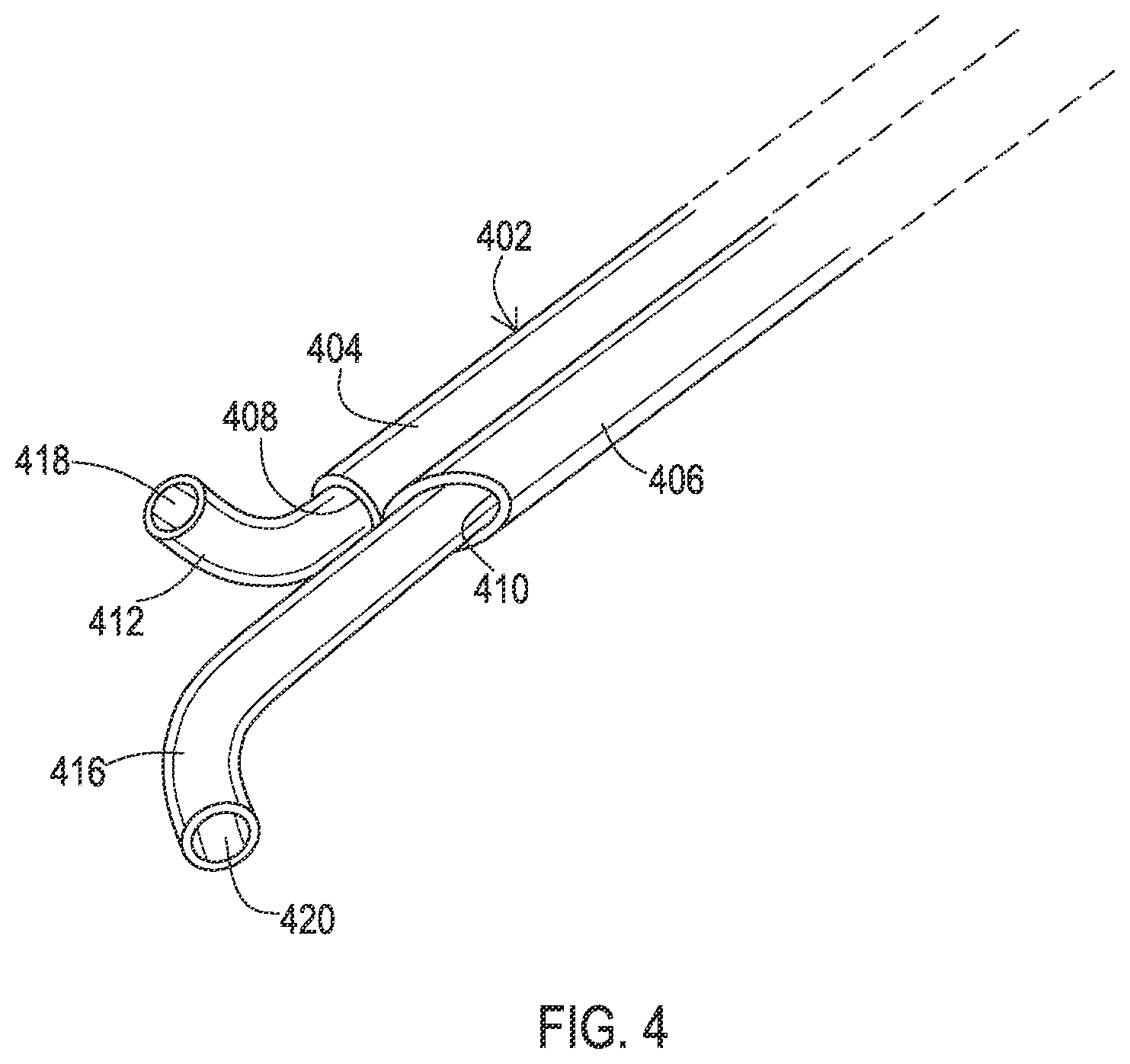 Patent US12137932 Figure 10 – Medical assemblies and methods for implantation of multiple medical leads through a single entry