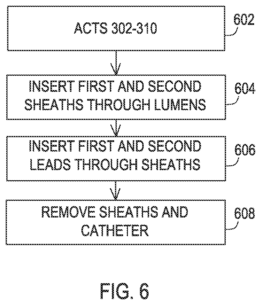 Patent US12137932 Figure 13 – Medical assemblies and methods for implantation of multiple medical leads through a single entry