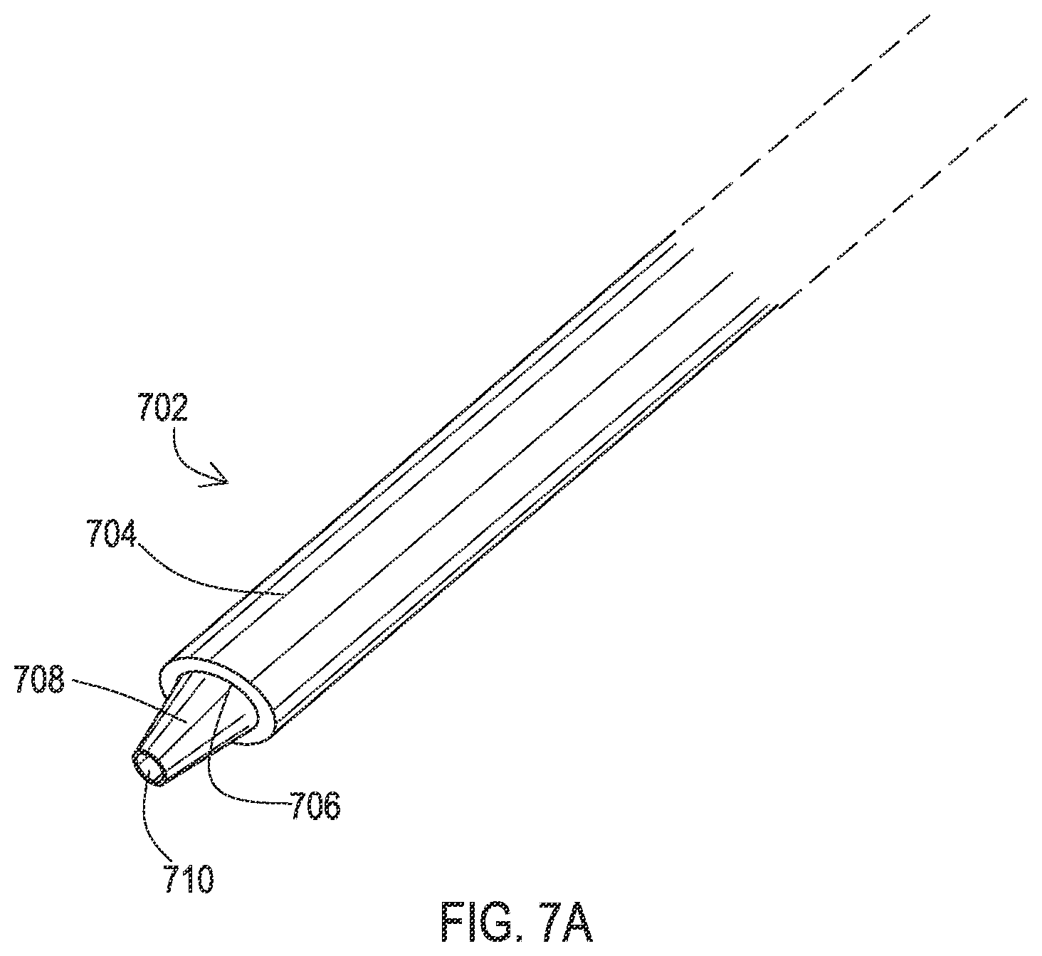 Patent US12137932 Figure 14 – Medical assemblies and methods for implantation of multiple medical leads through a single entry