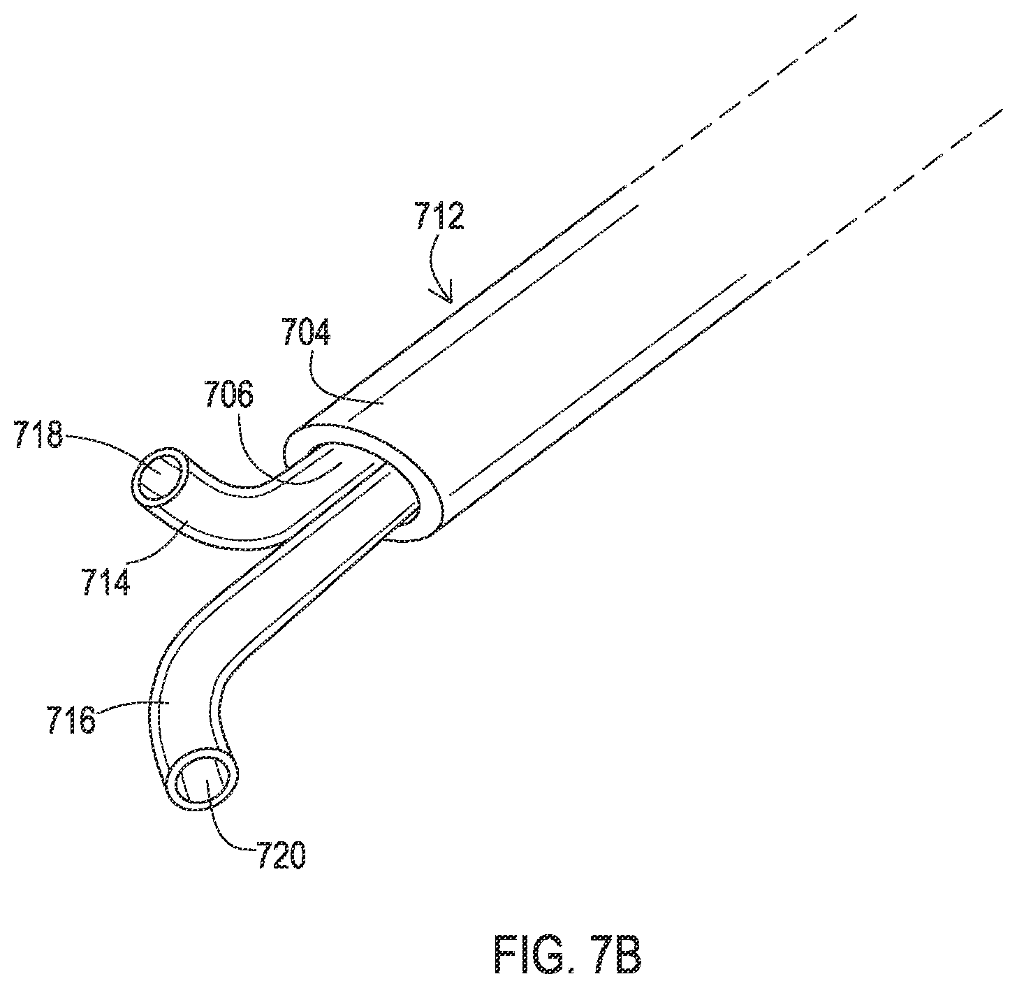 Patent US12137932 Figure 15 – Medical assemblies and methods for implantation of multiple medical leads through a single entry
