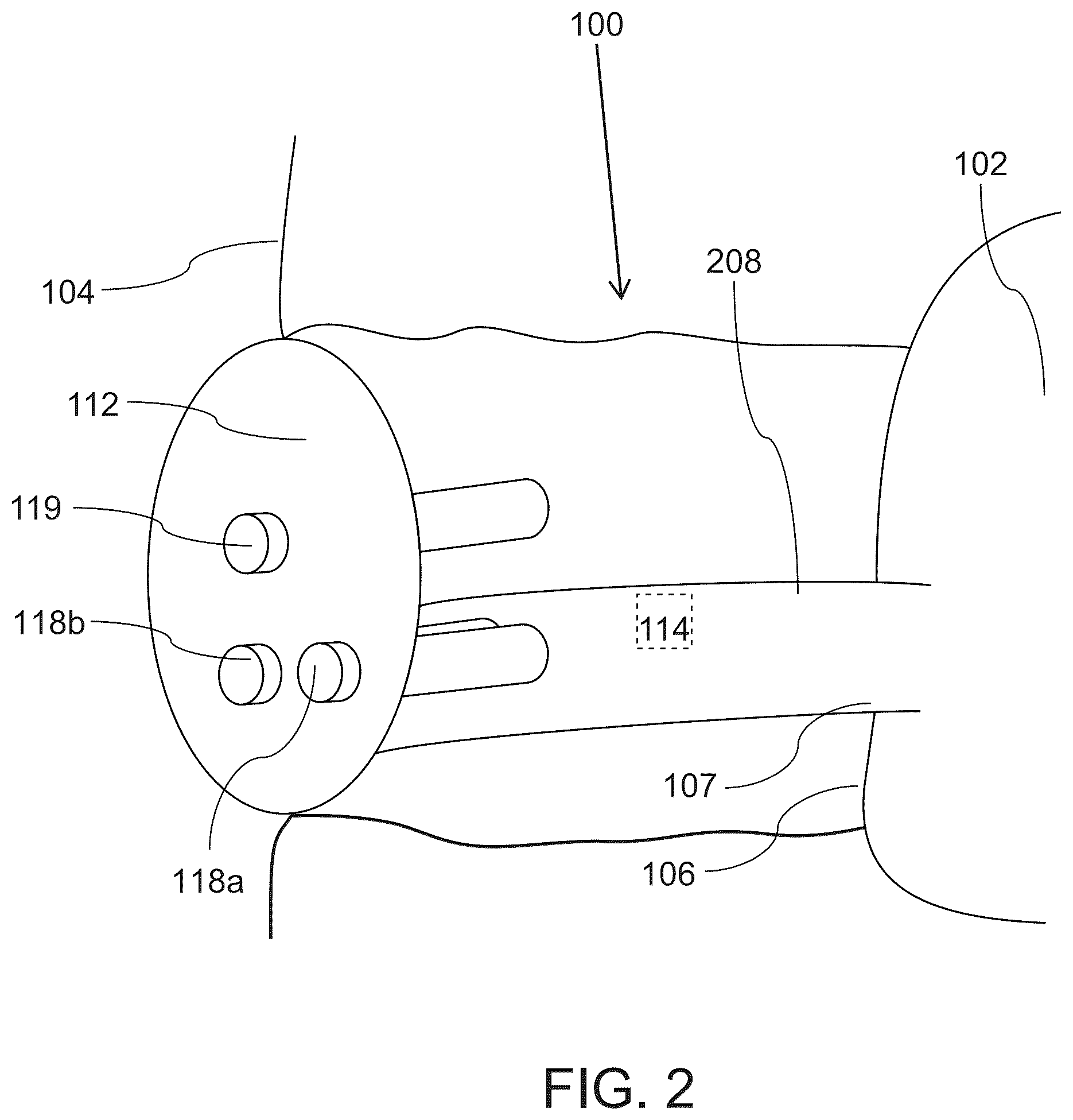 Patent US12137933 Figure 2 – Tools and methods for vaginal access