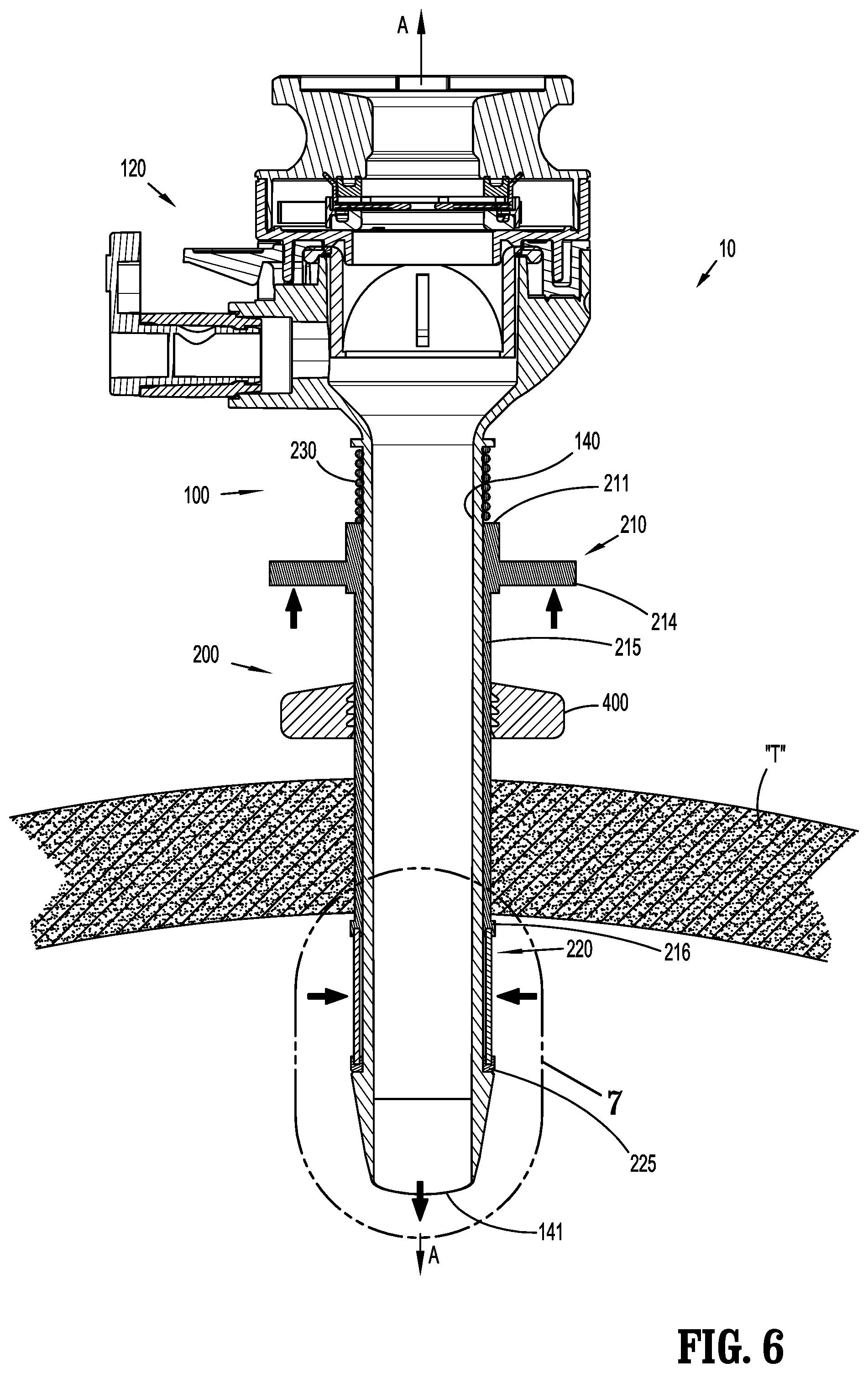 Patent US12137934 Figure 5 – Surgical access device with fixation mechanism