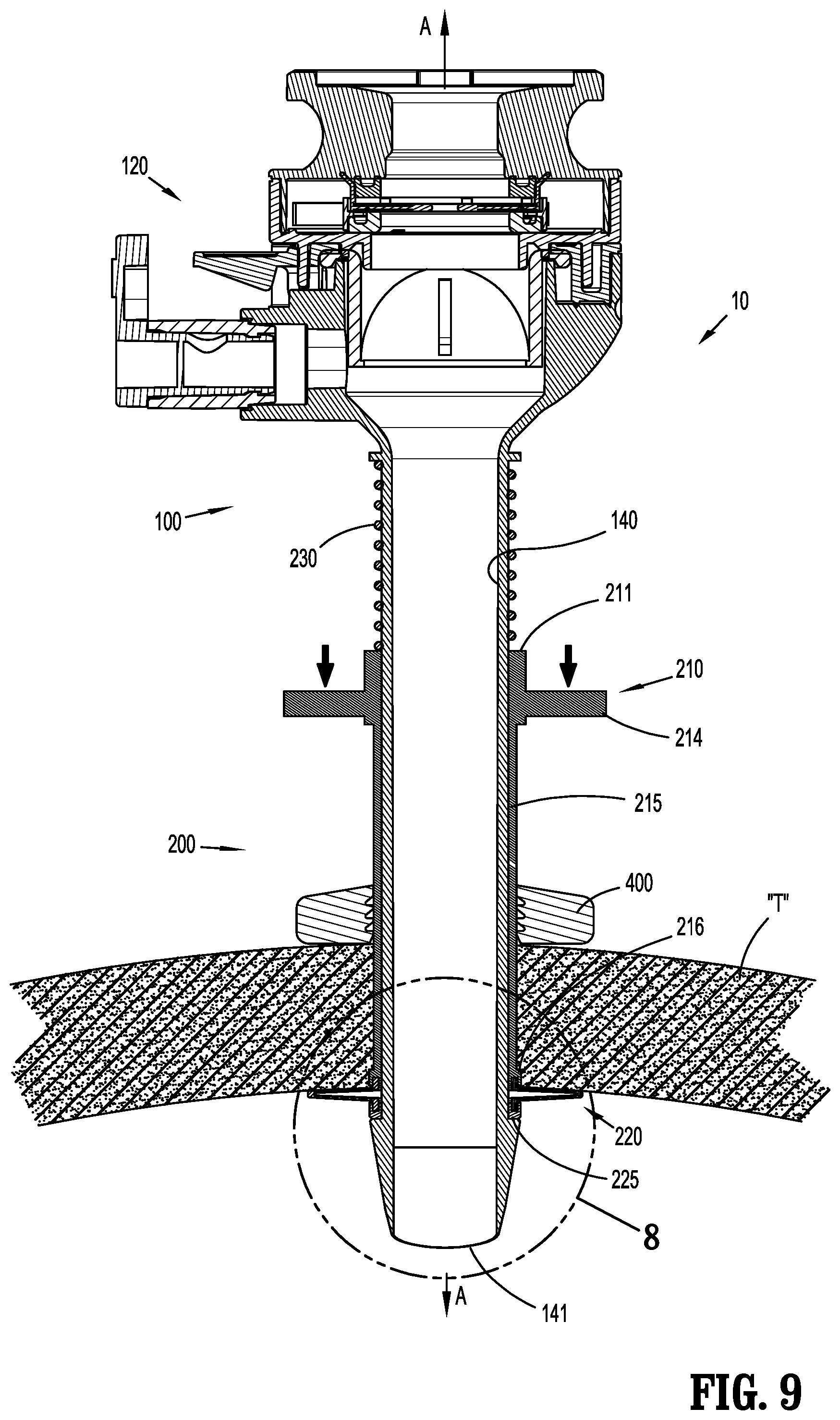 Patent US12137934 Figure 7 – Surgical access device with fixation mechanism