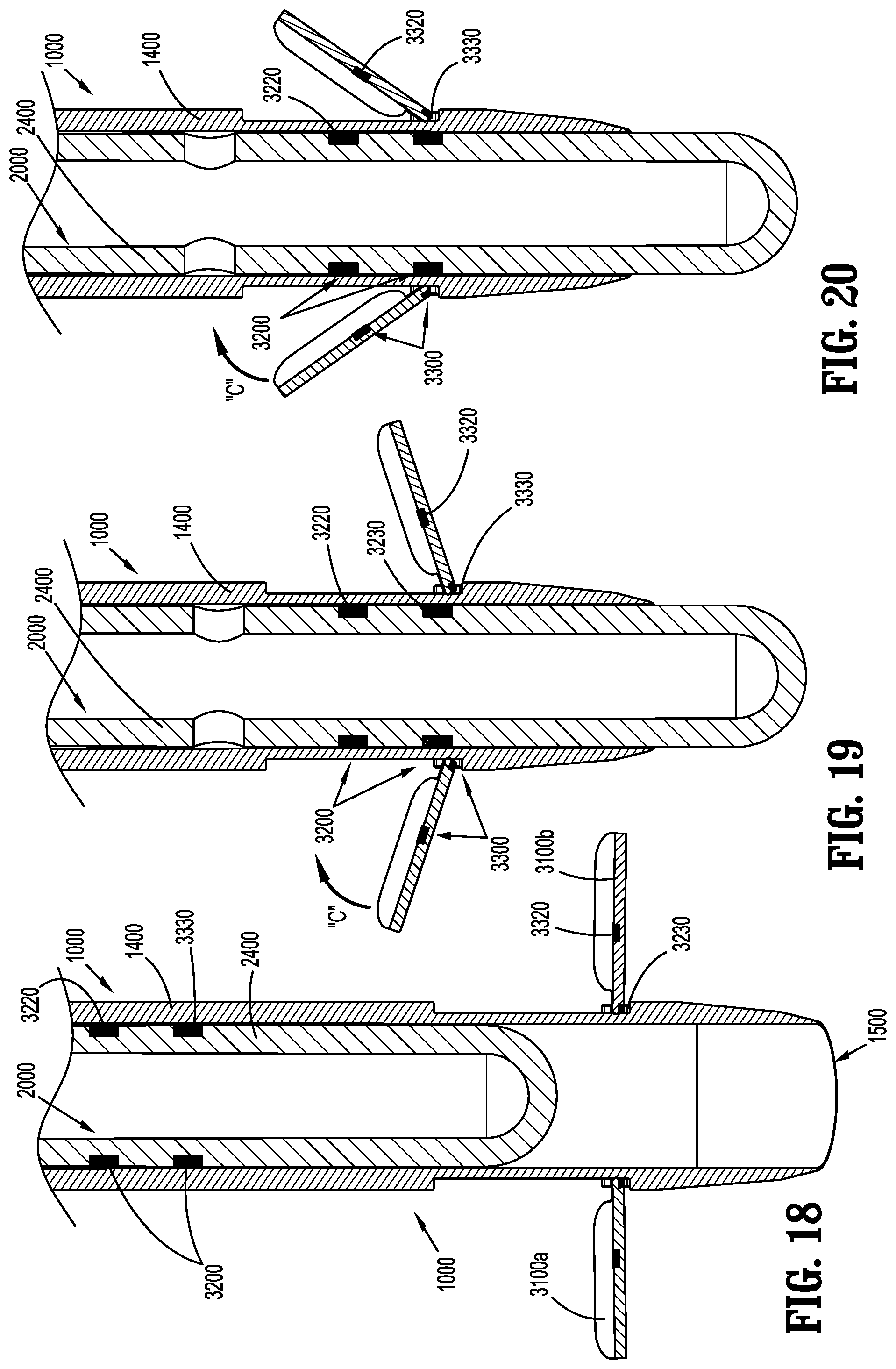 Patent US12137934 Figure 12 – Surgical access device with fixation mechanism
