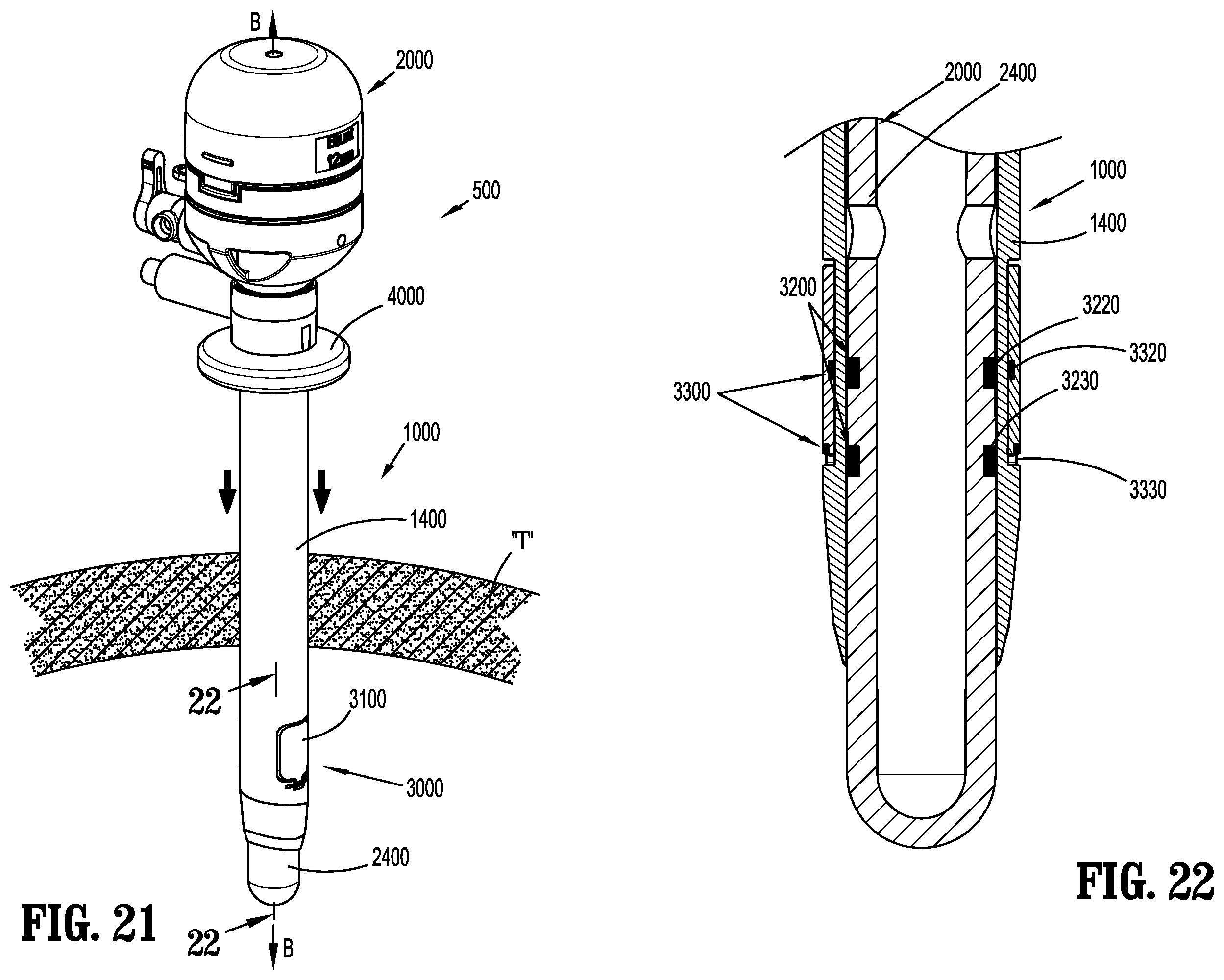 Patent US12137934 Figure 13 – Surgical access device with fixation mechanism
