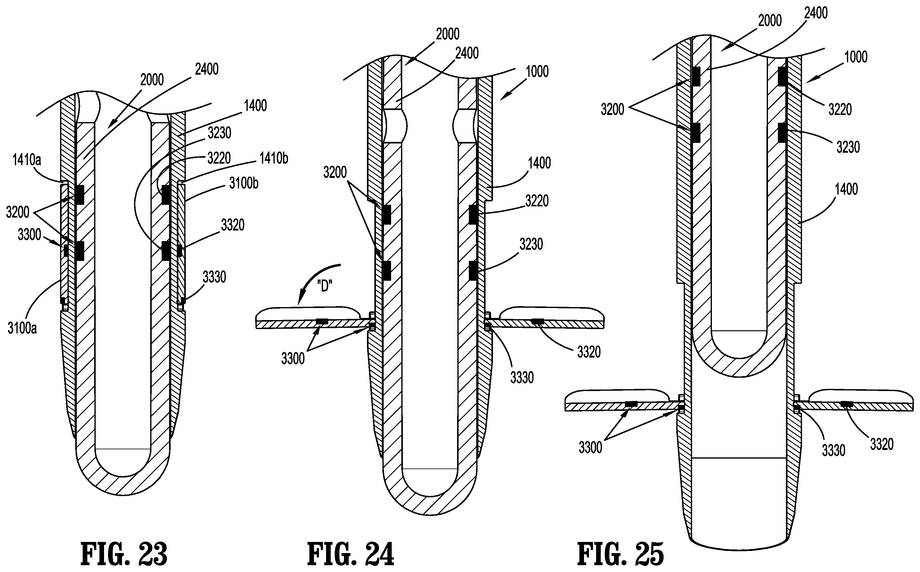 Patent US12137934 Figure 14 – Surgical access device with fixation mechanism