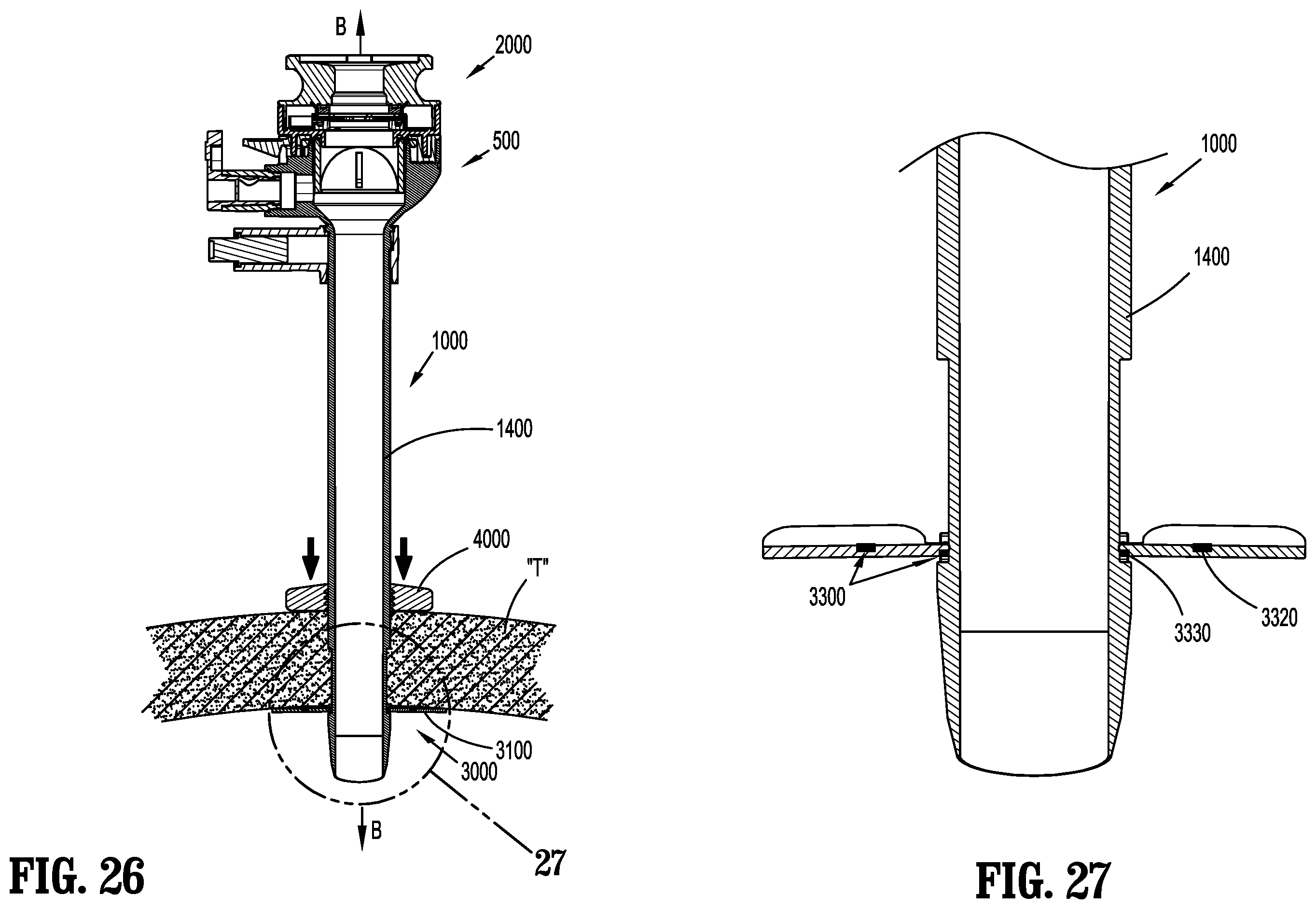 Patent US12137934 Figure 15 – Surgical access device with fixation mechanism