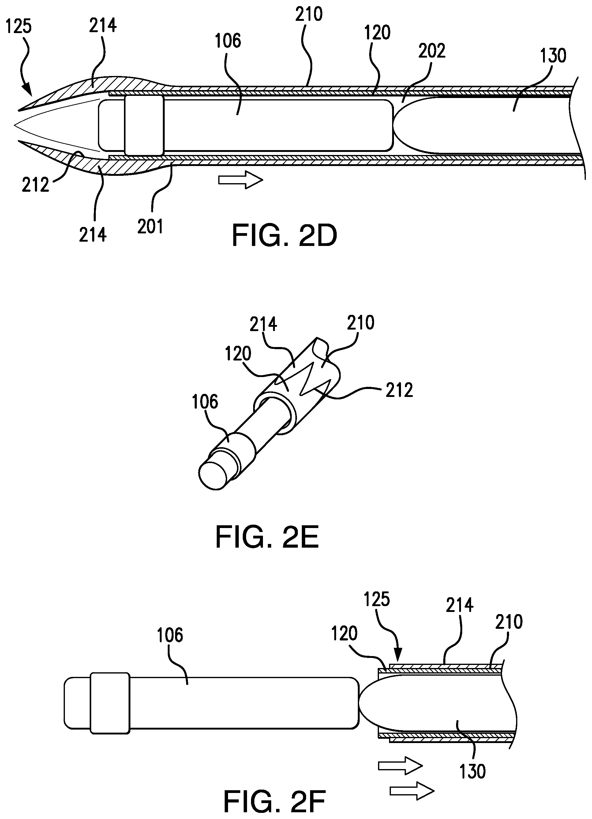 Patent US12137937 Figure 3 – Insertion tool with a dissector