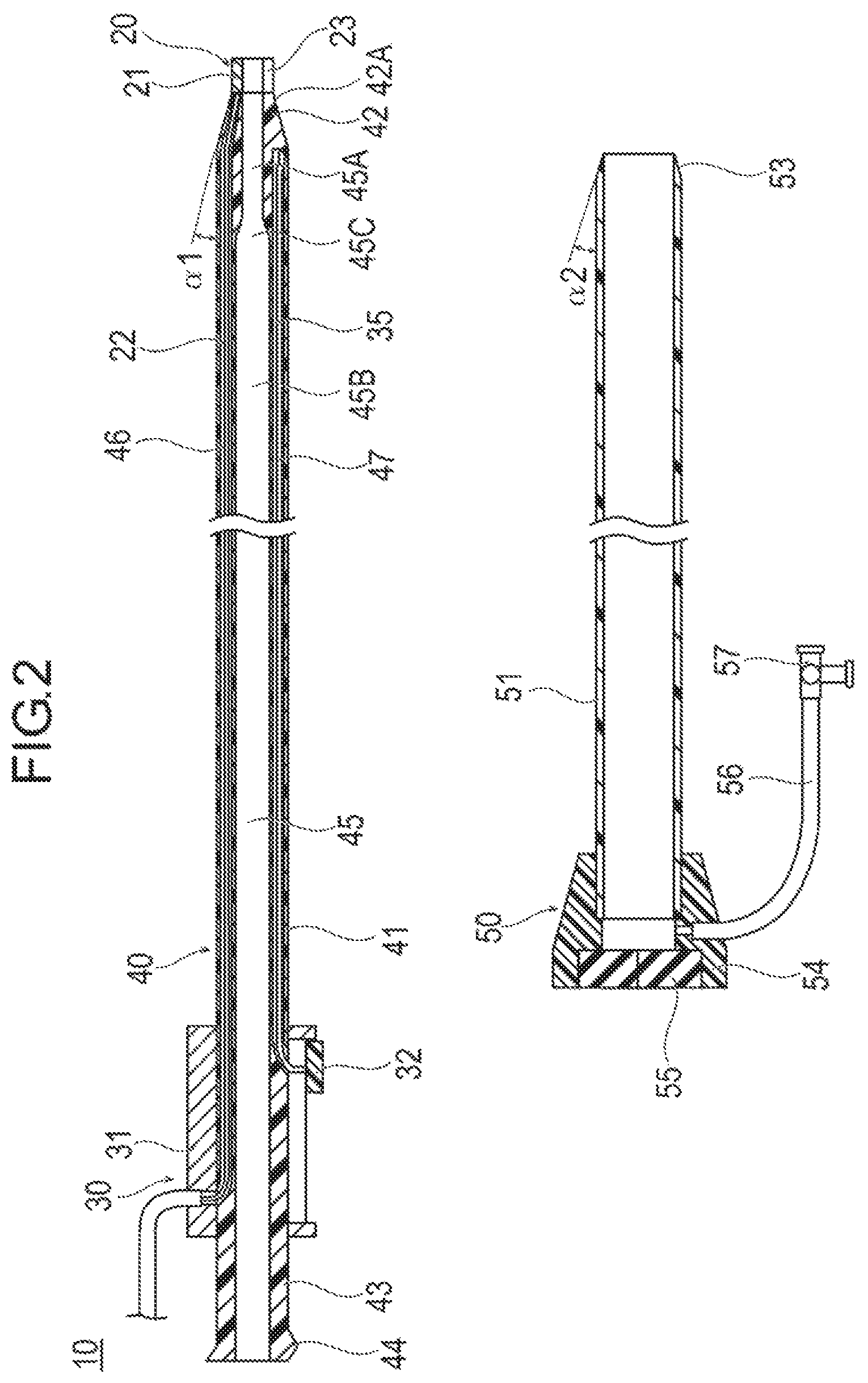 Patent US12137939 Figure 2 – Medical device and treatment method