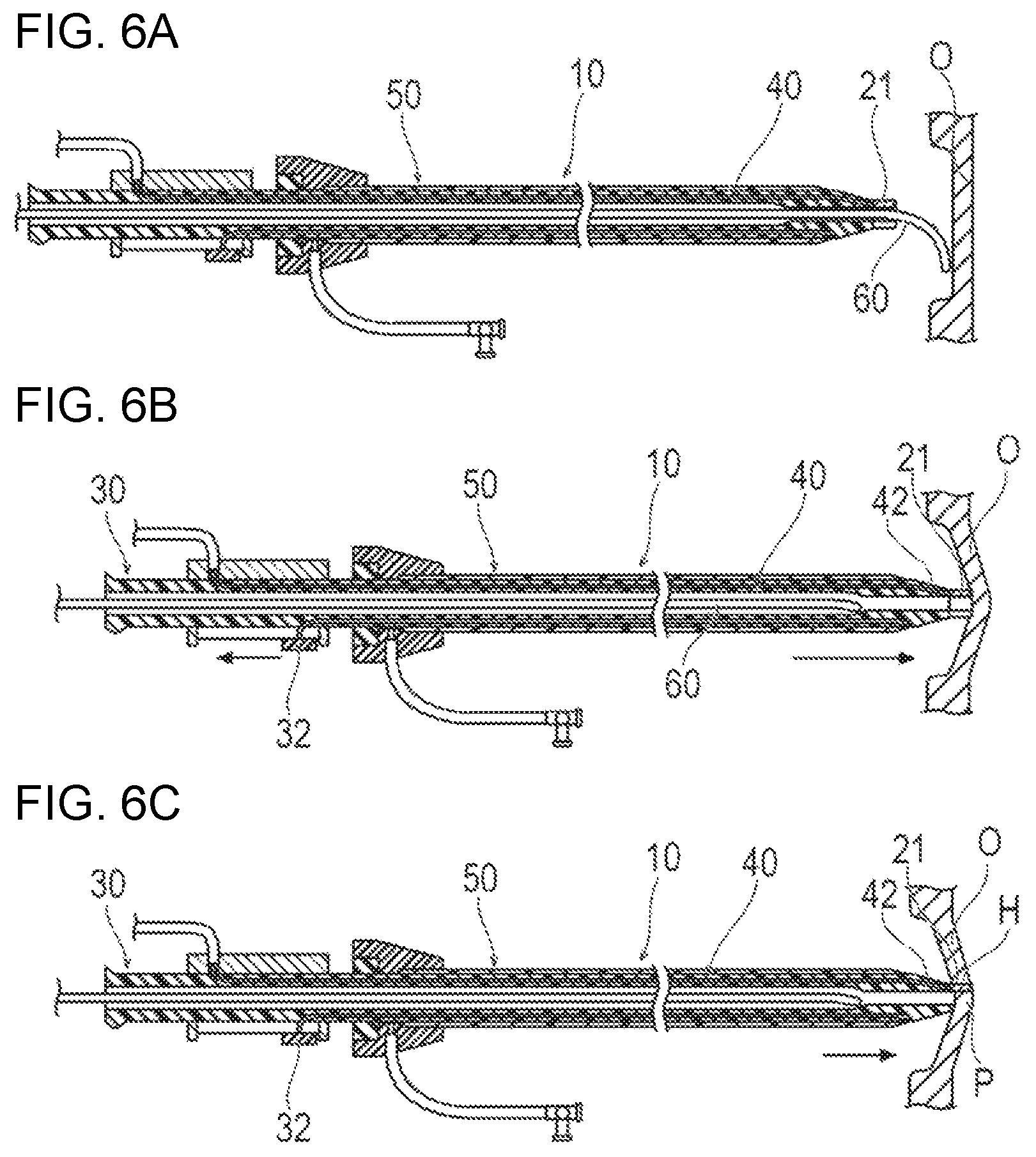 Patent US12137939 Figure 5 – Medical device and treatment method