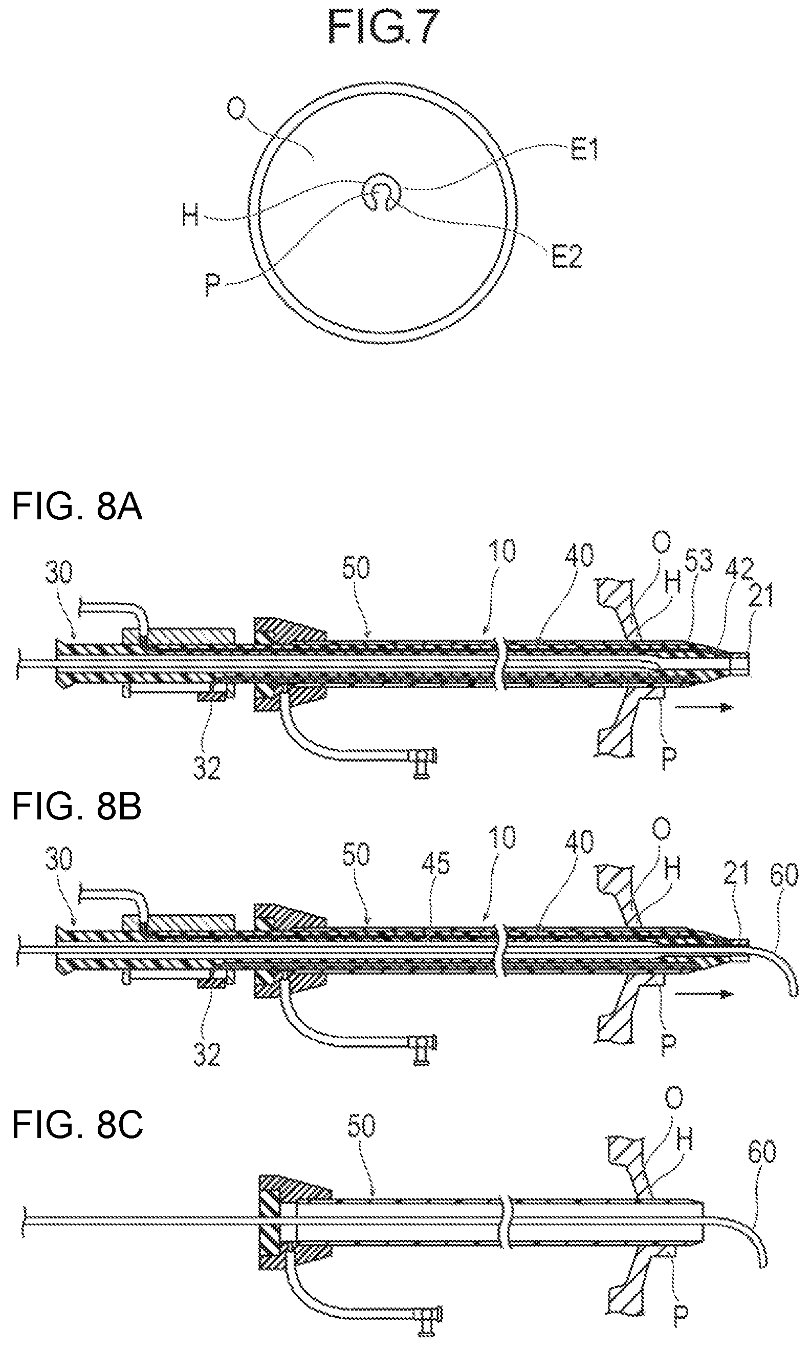Patent US12137939 Figure 6 – Medical device and treatment method
