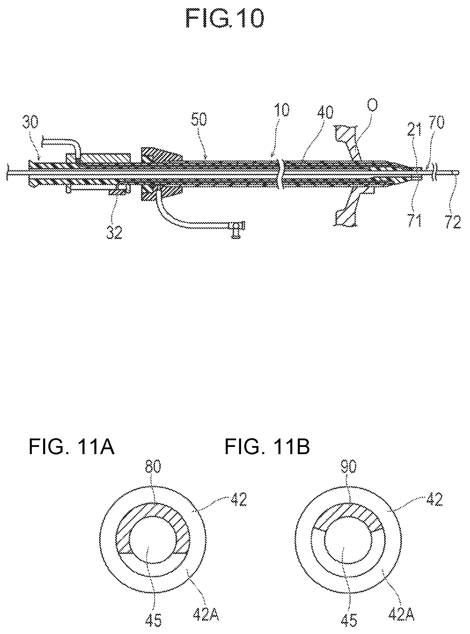 Patent US12137939 Figure 8 – Medical device and treatment method