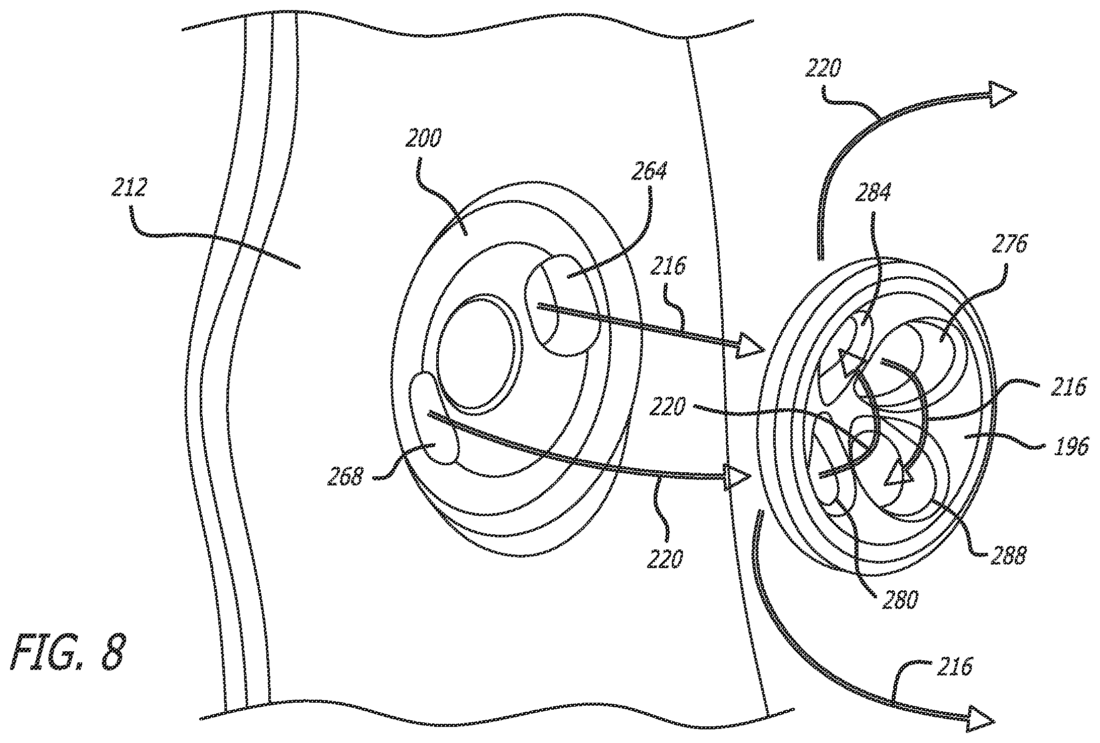 Patent US12137942 Figure 5 – Syndesmosis treatment construct