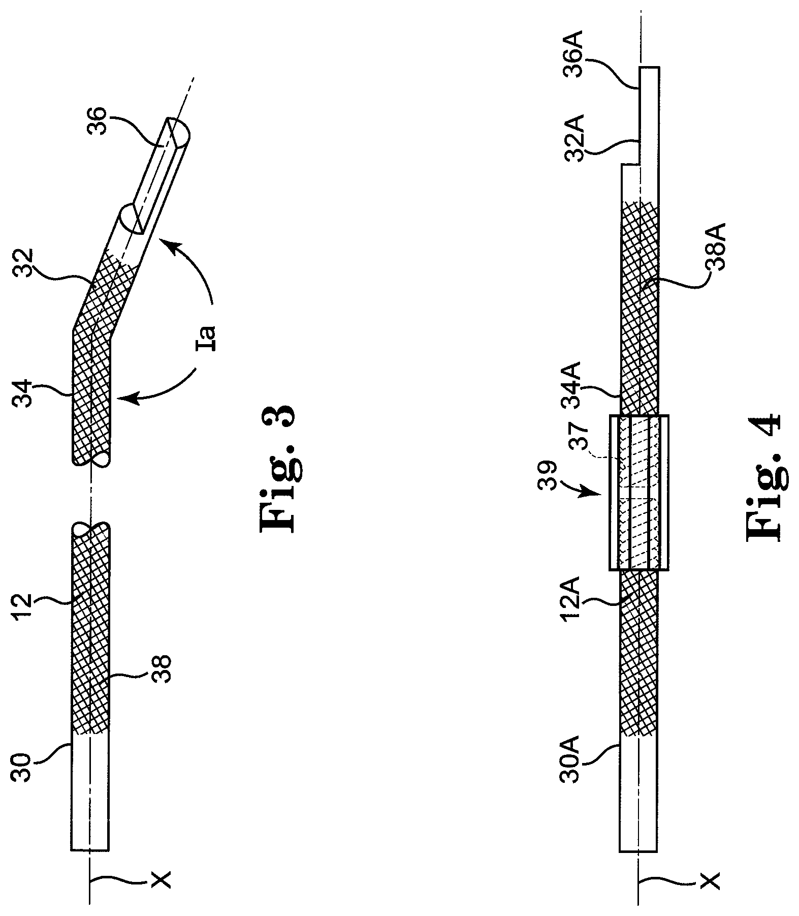 Patent US12137943 Figure 3 – Semi-constrained anchoring system