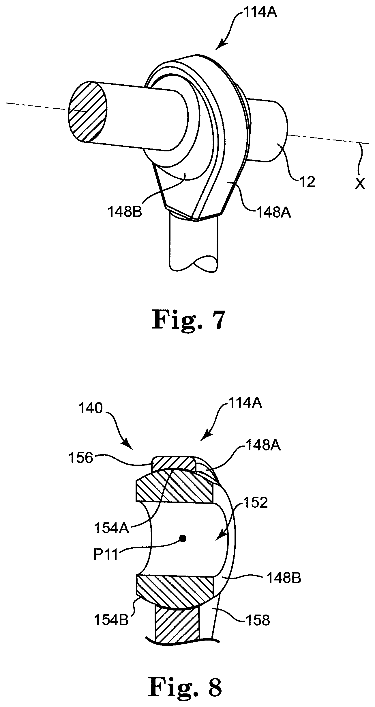 Patent US12137943 Figure 5 – Semi-constrained anchoring system