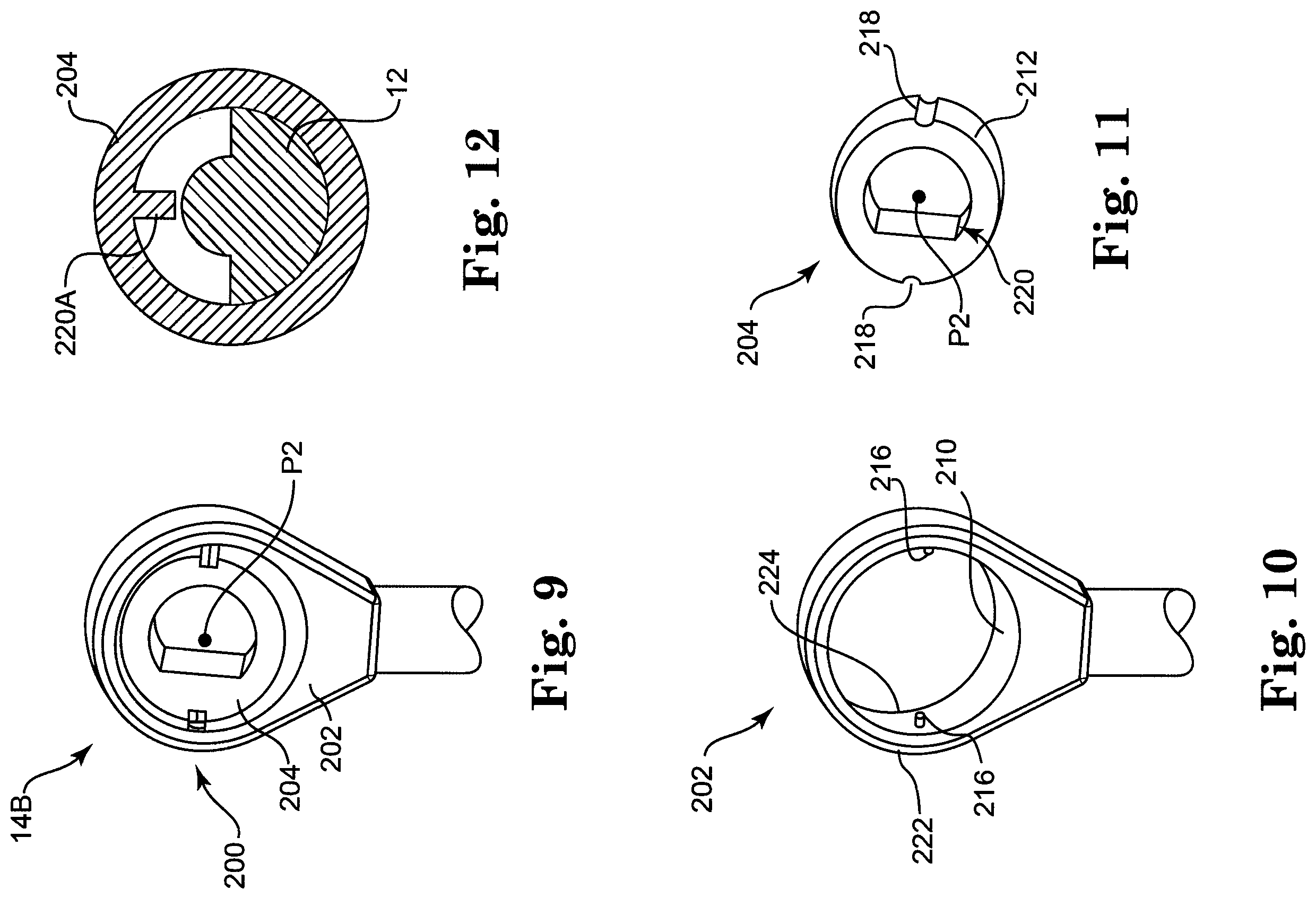 Patent US12137943 Figure 6 – Semi-constrained anchoring system