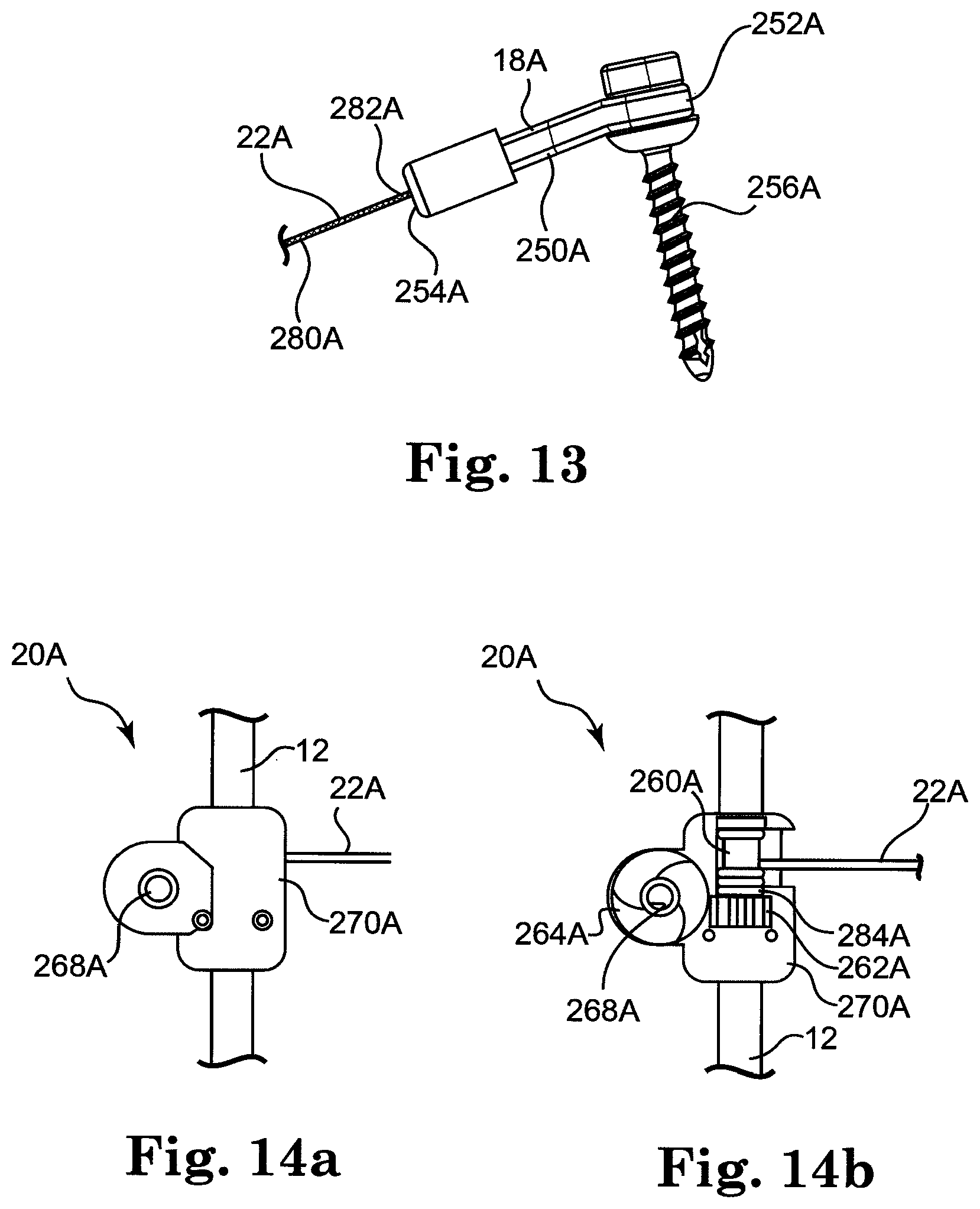 Patent US12137943 Figure 7 – Semi-constrained anchoring system