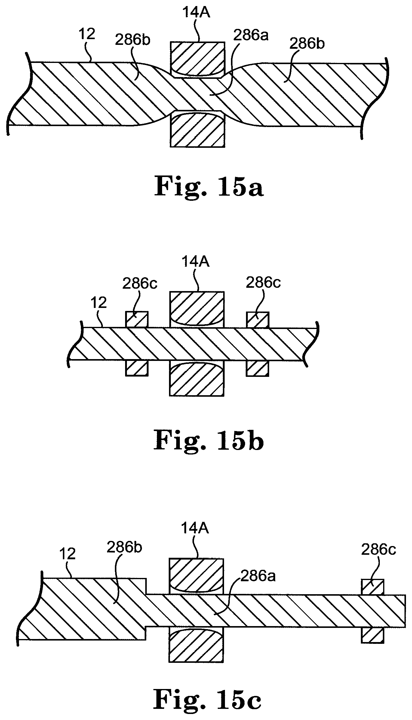 Patent US12137943 Figure 8 – Semi-constrained anchoring system