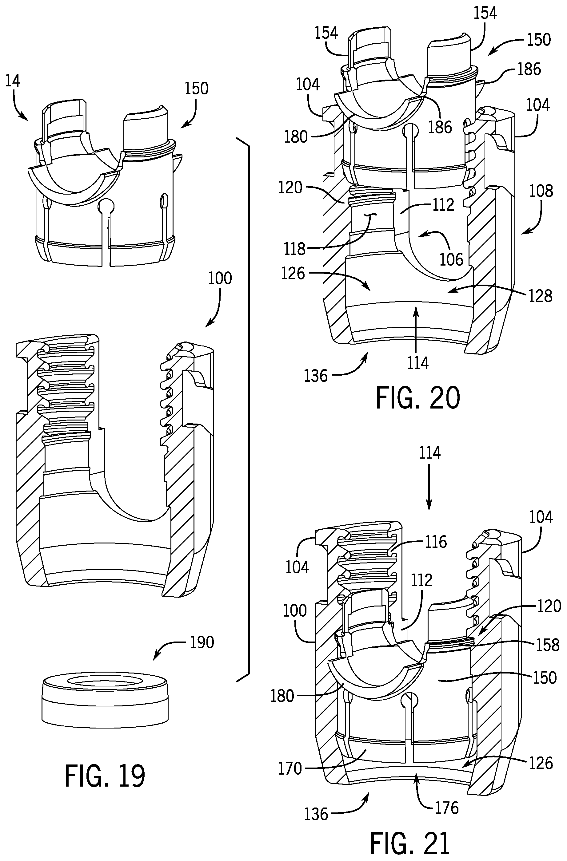 Patent US12137944 Figure 5 – Bone anchor assembly having a tool deployable insert in compressive overlapping engagement with a retainer