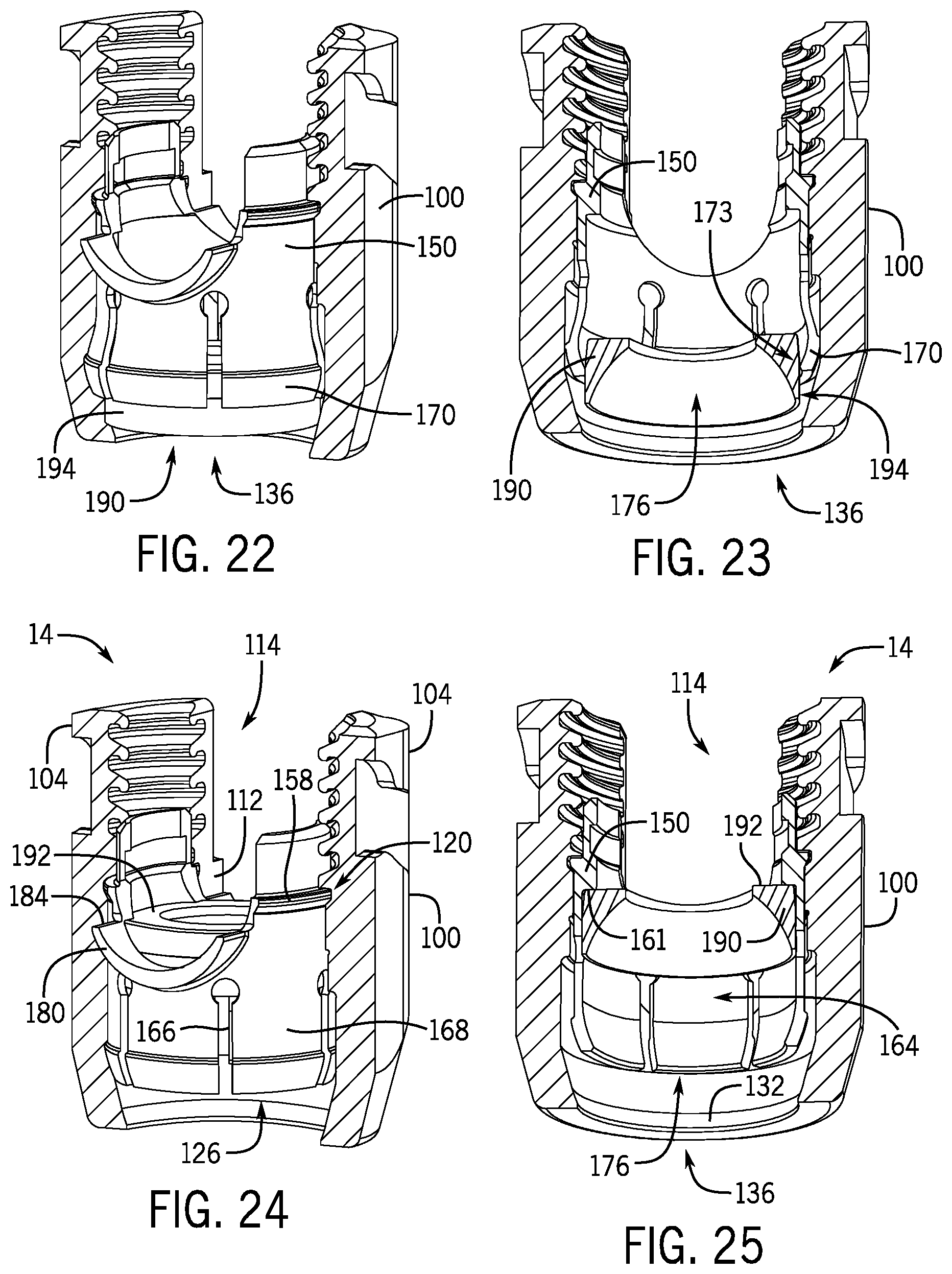 Patent US12137944 Figure 6 – Bone anchor assembly having a tool deployable insert in compressive overlapping engagement with a retainer