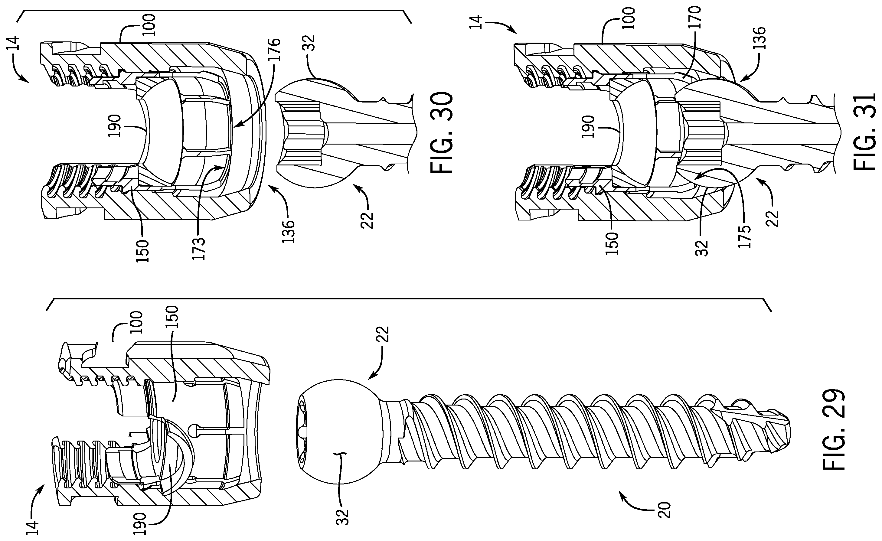 Patent US12137944 Figure 8 – Bone anchor assembly having a tool deployable insert in compressive overlapping engagement with a retainer