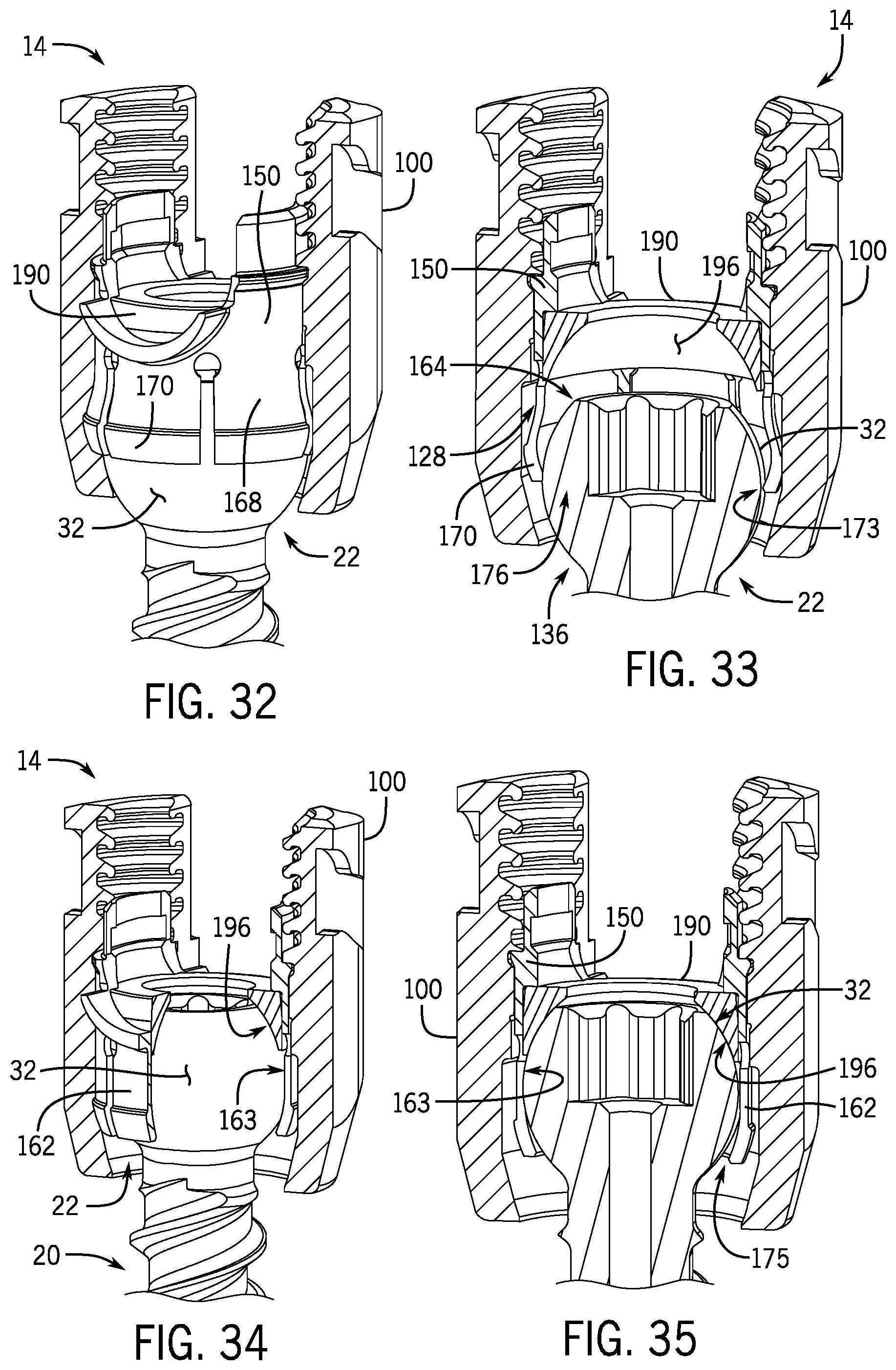 Patent US12137944 Figure 9 – Bone anchor assembly having a tool deployable insert in compressive overlapping engagement with a retainer