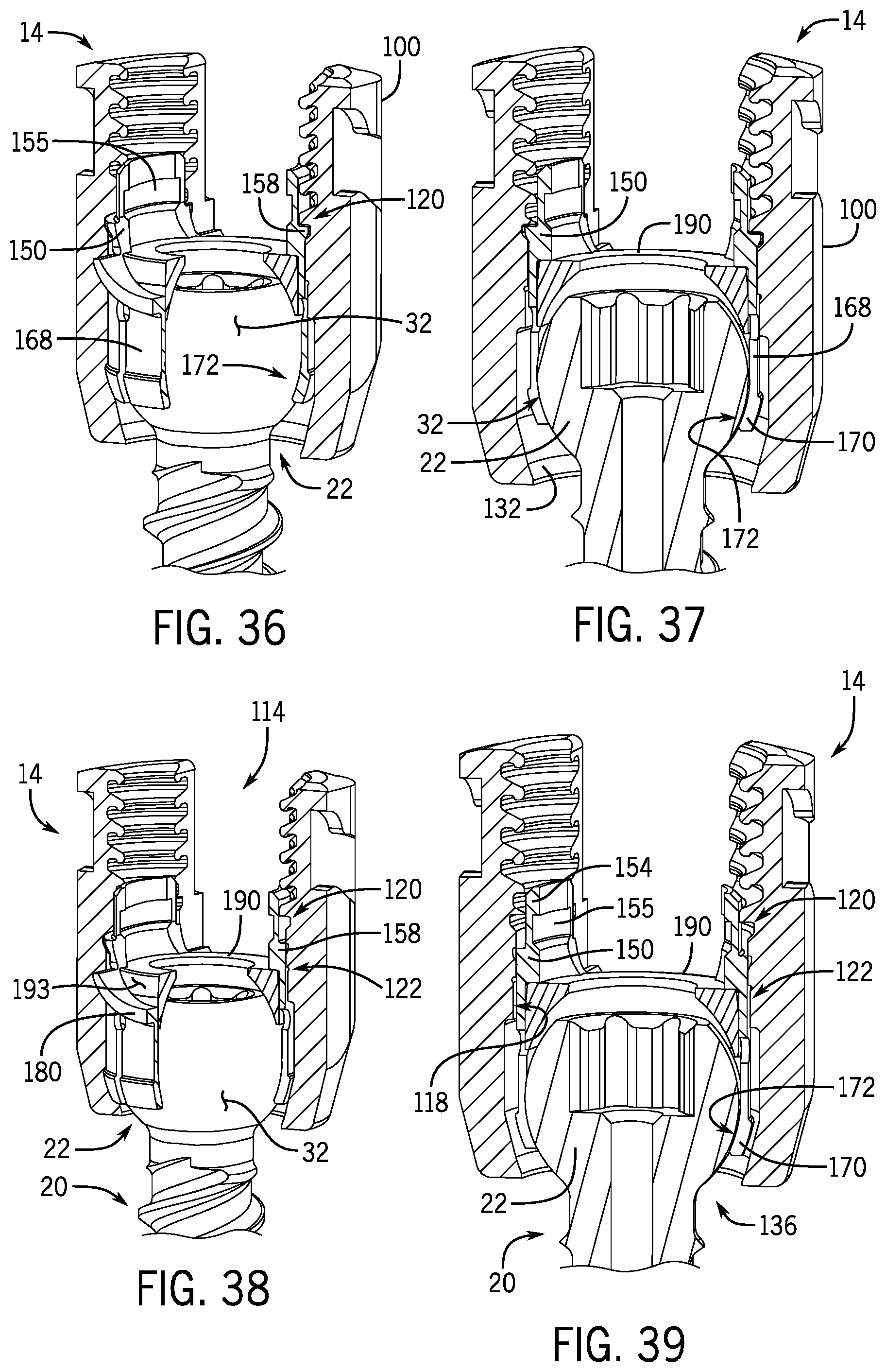 Patent US12137944 Figure 10 – Bone anchor assembly having a tool deployable insert in compressive overlapping engagement with a retainer