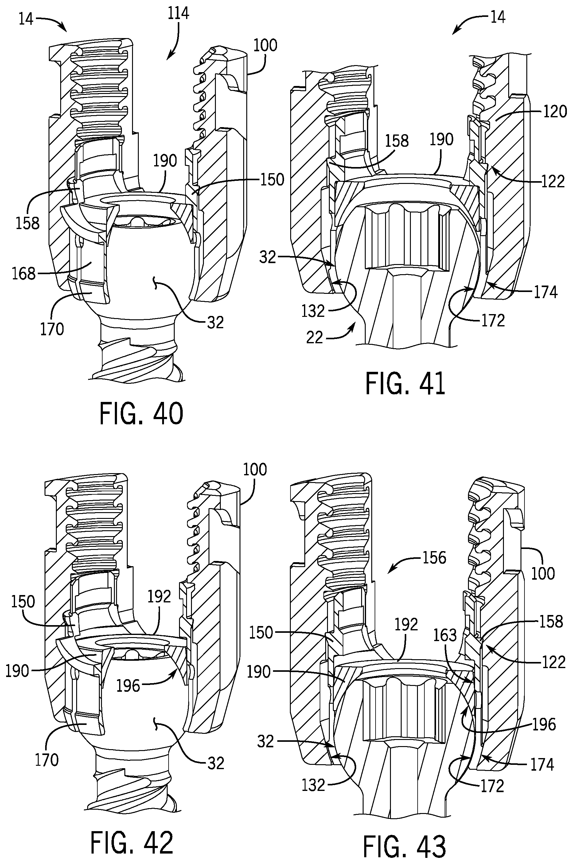 Patent US12137944 Figure 11 – Bone anchor assembly having a tool deployable insert in compressive overlapping engagement with a retainer