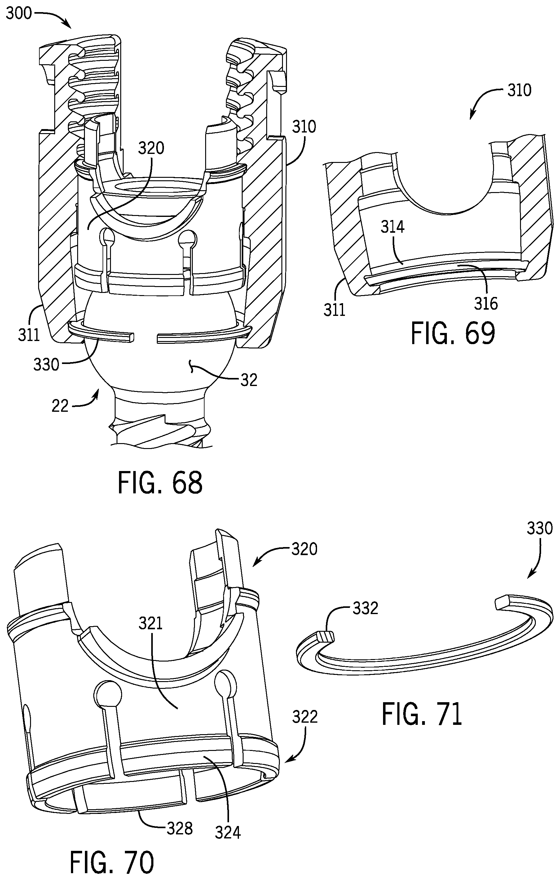 Patent US12137944 Figure 20 – Bone anchor assembly having a tool deployable insert in compressive overlapping engagement with a retainer
