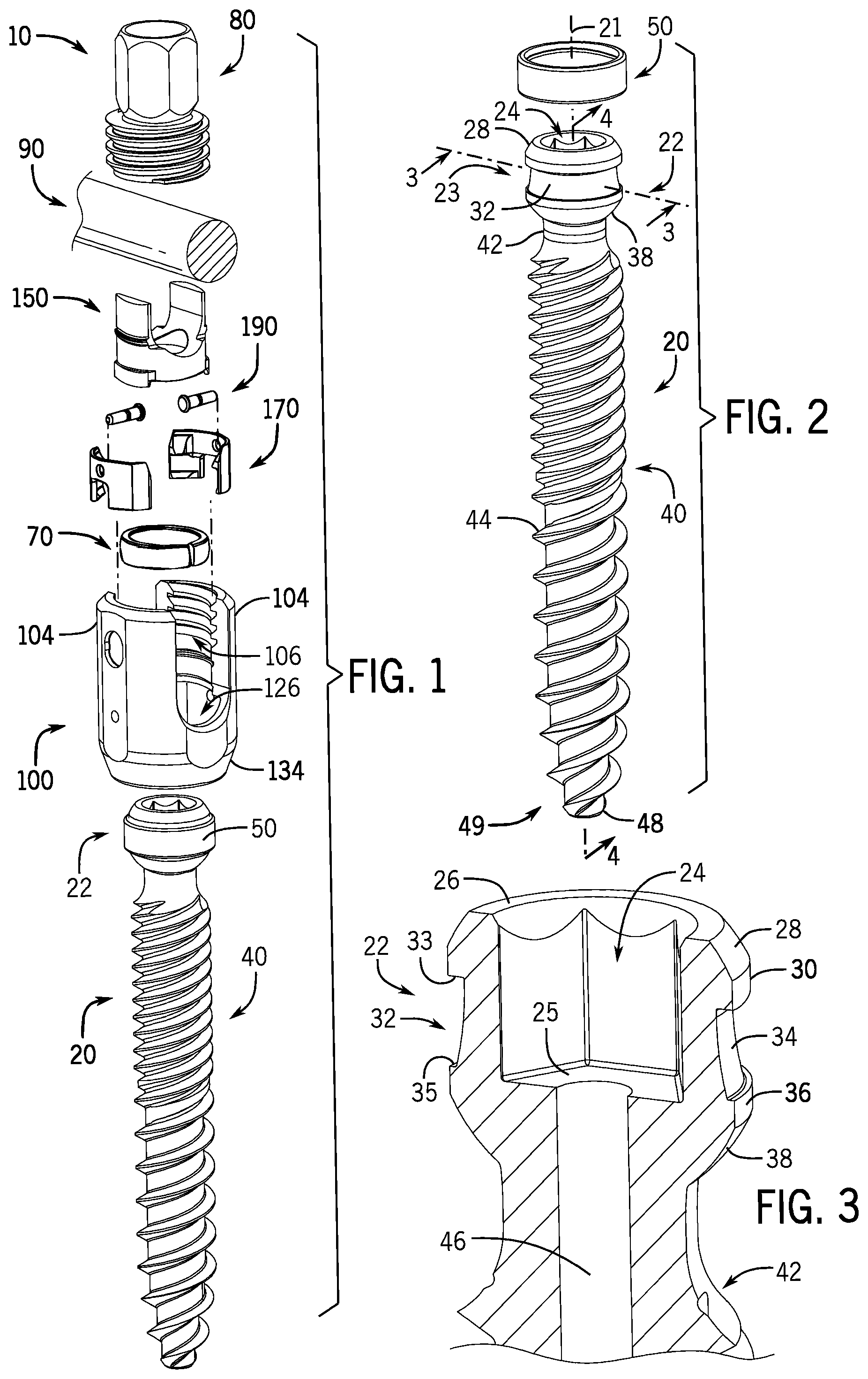 Patent US12137945 Figure 1 – Pivotal bone anchor system with modular receiver sub-assemblies and universal bone anchors