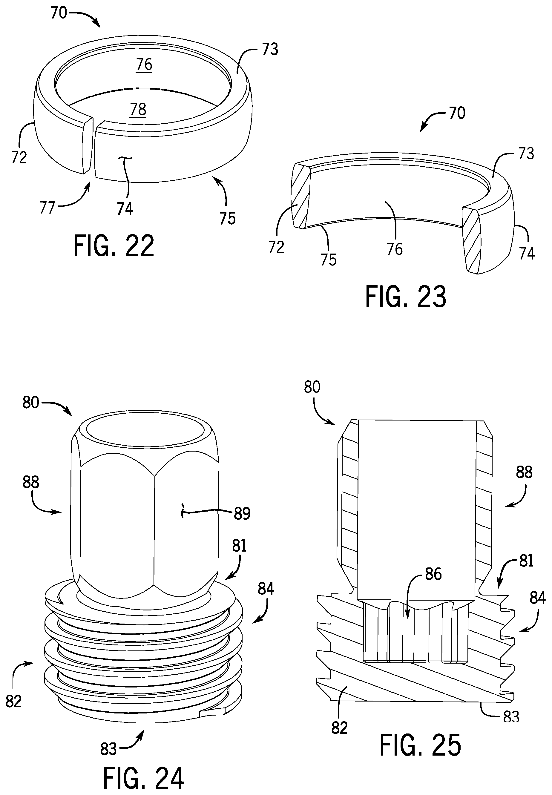 Patent US12137945 Figure 6 – Pivotal bone anchor system with modular receiver sub-assemblies and universal bone anchors