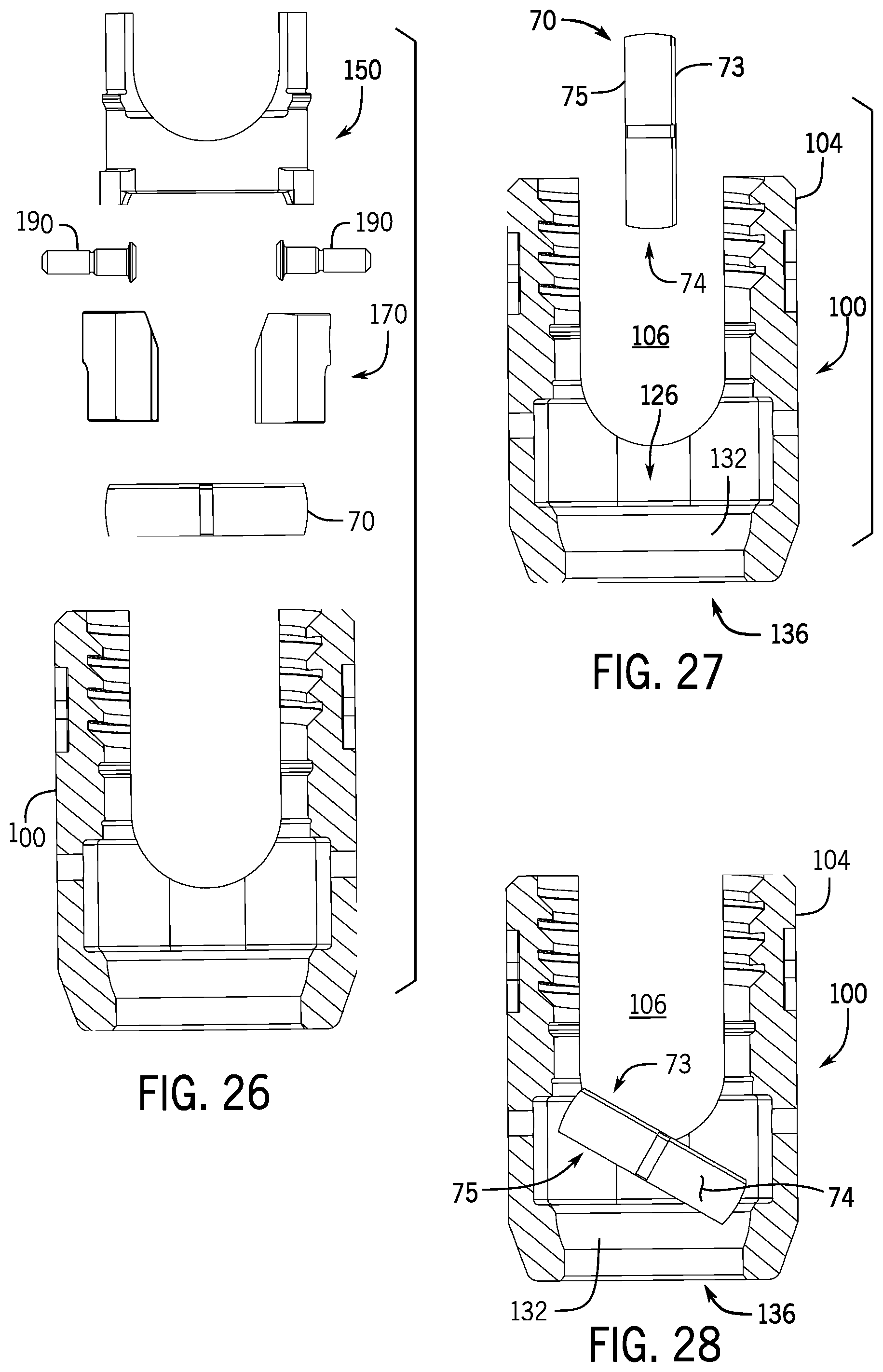 Patent US12137945 Figure 7 – Pivotal bone anchor system with modular receiver sub-assemblies and universal bone anchors