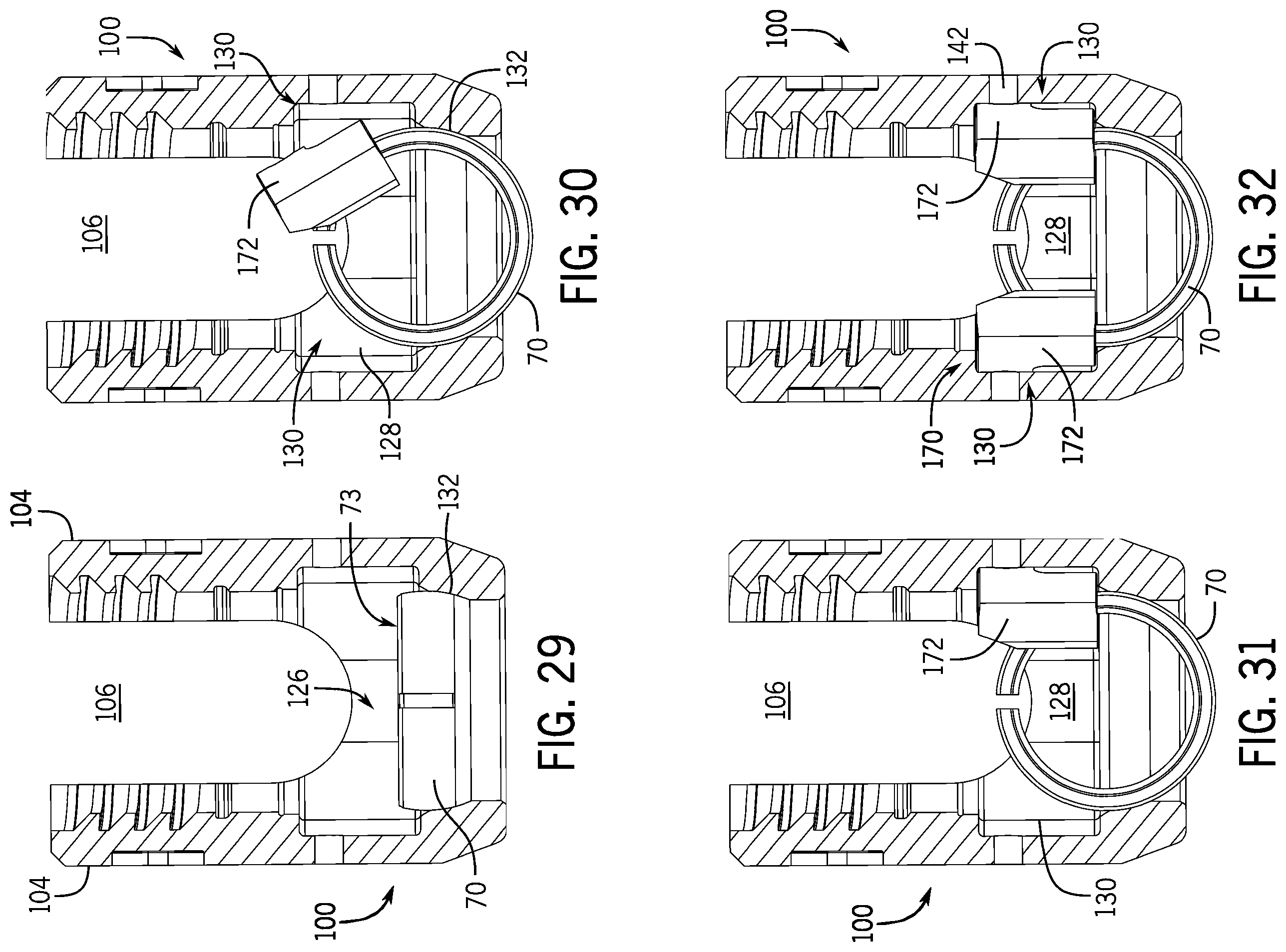 Patent US12137945 Figure 8 – Pivotal bone anchor system with modular receiver sub-assemblies and universal bone anchors
