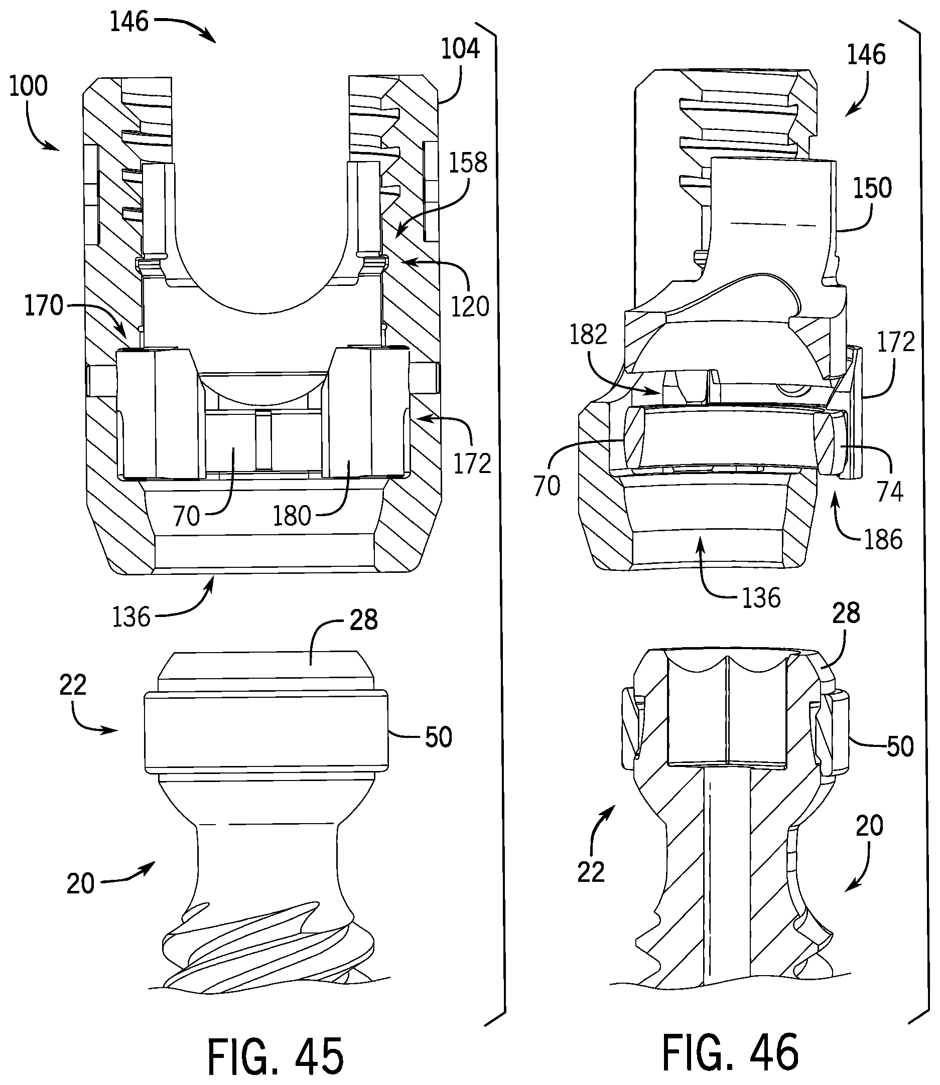 Patent US12137945 Figure 12 – Pivotal bone anchor system with modular receiver sub-assemblies and universal bone anchors