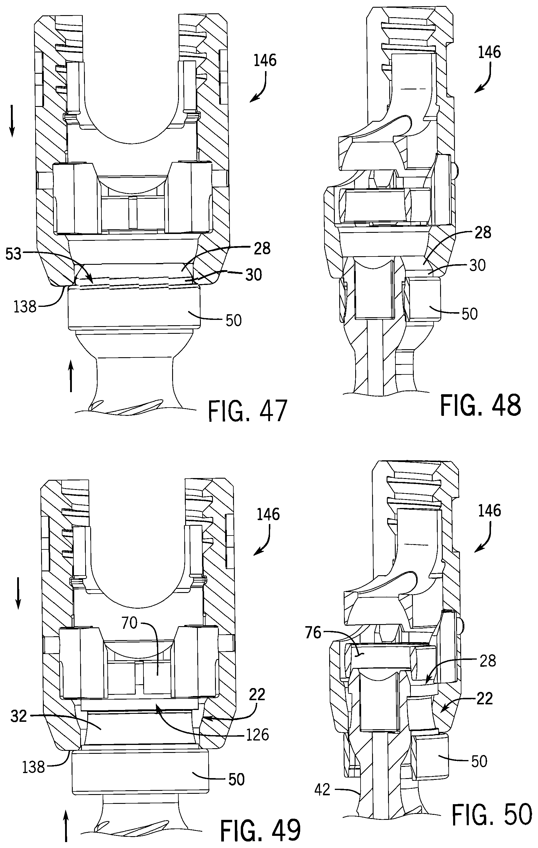 Patent US12137945 Figure 13 – Pivotal bone anchor system with modular receiver sub-assemblies and universal bone anchors