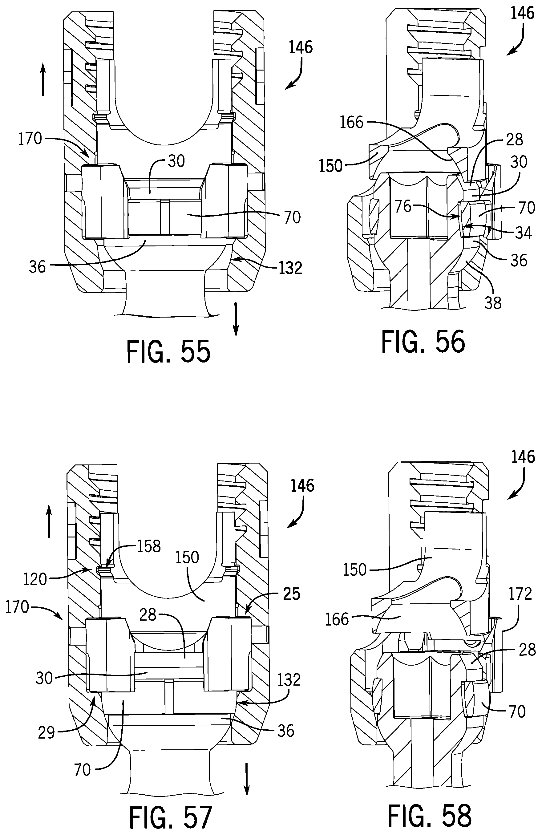 Patent US12137945 Figure 15 – Pivotal bone anchor system with modular receiver sub-assemblies and universal bone anchors