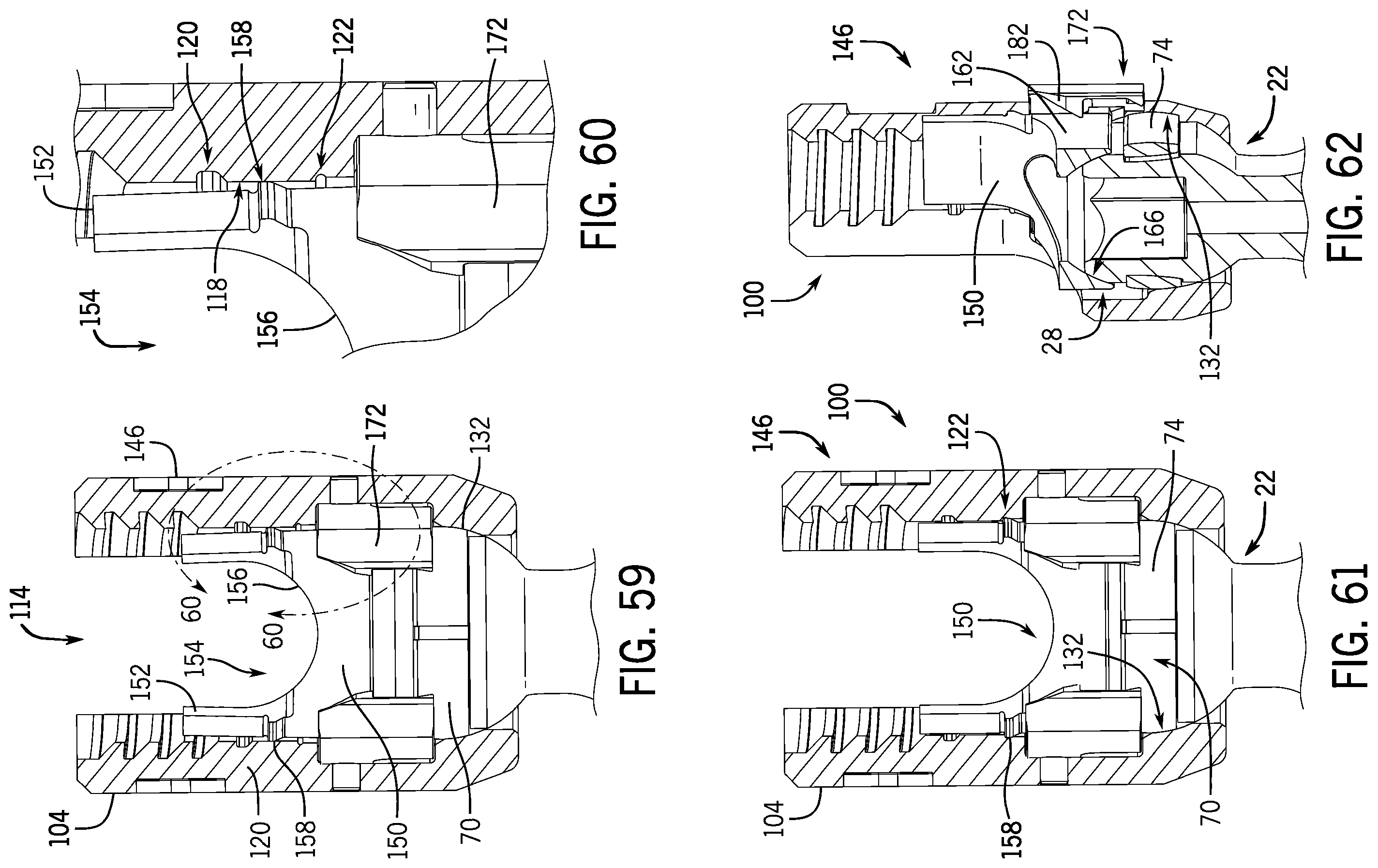 Patent US12137945 Figure 16 – Pivotal bone anchor system with modular receiver sub-assemblies and universal bone anchors