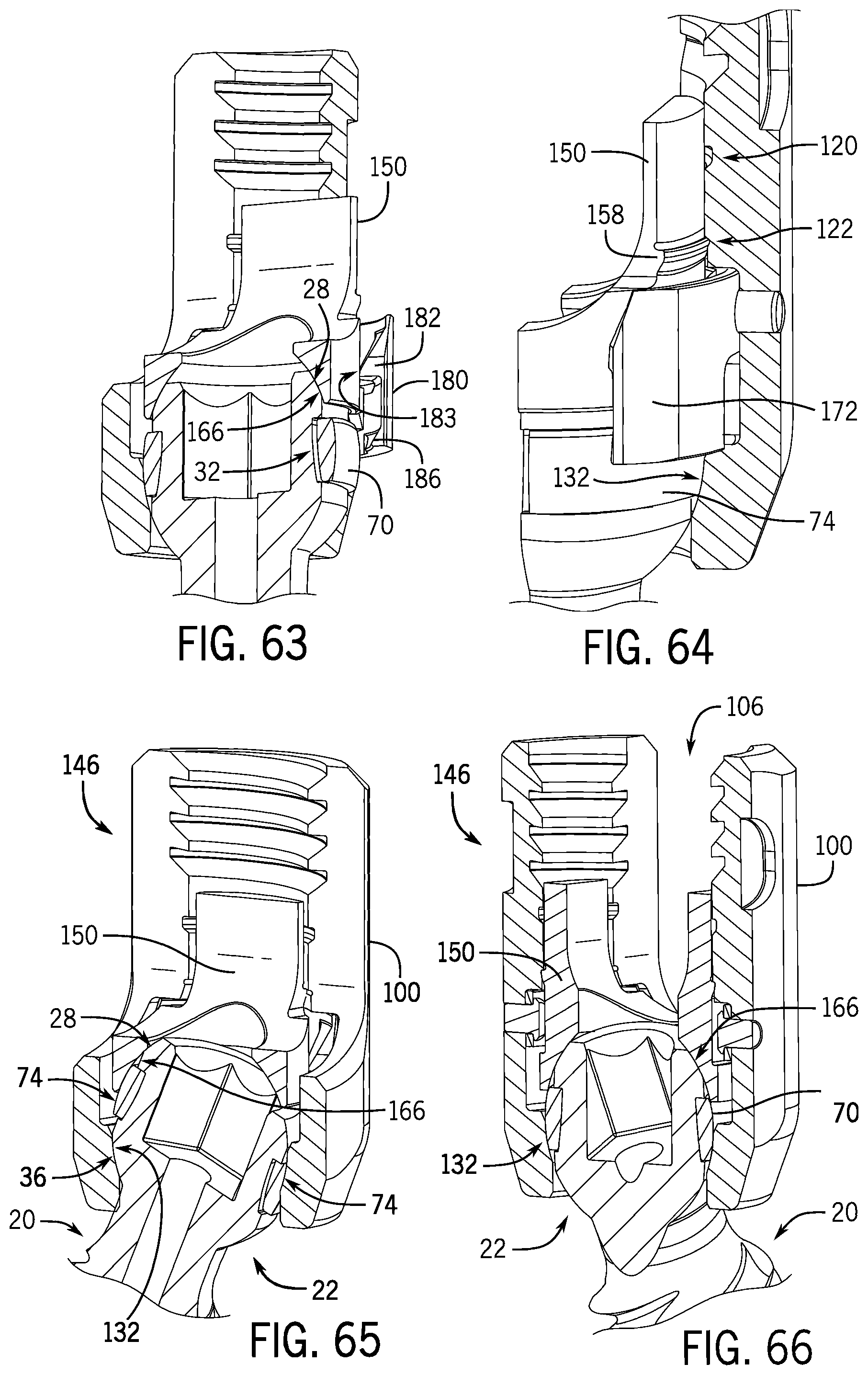 Patent US12137945 Figure 17 – Pivotal bone anchor system with modular receiver sub-assemblies and universal bone anchors