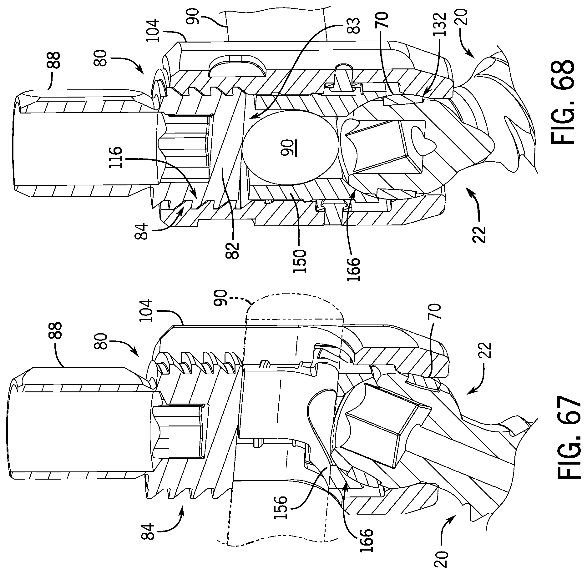 Patent US12137945 Figure 18 – Pivotal bone anchor system with modular receiver sub-assemblies and universal bone anchors