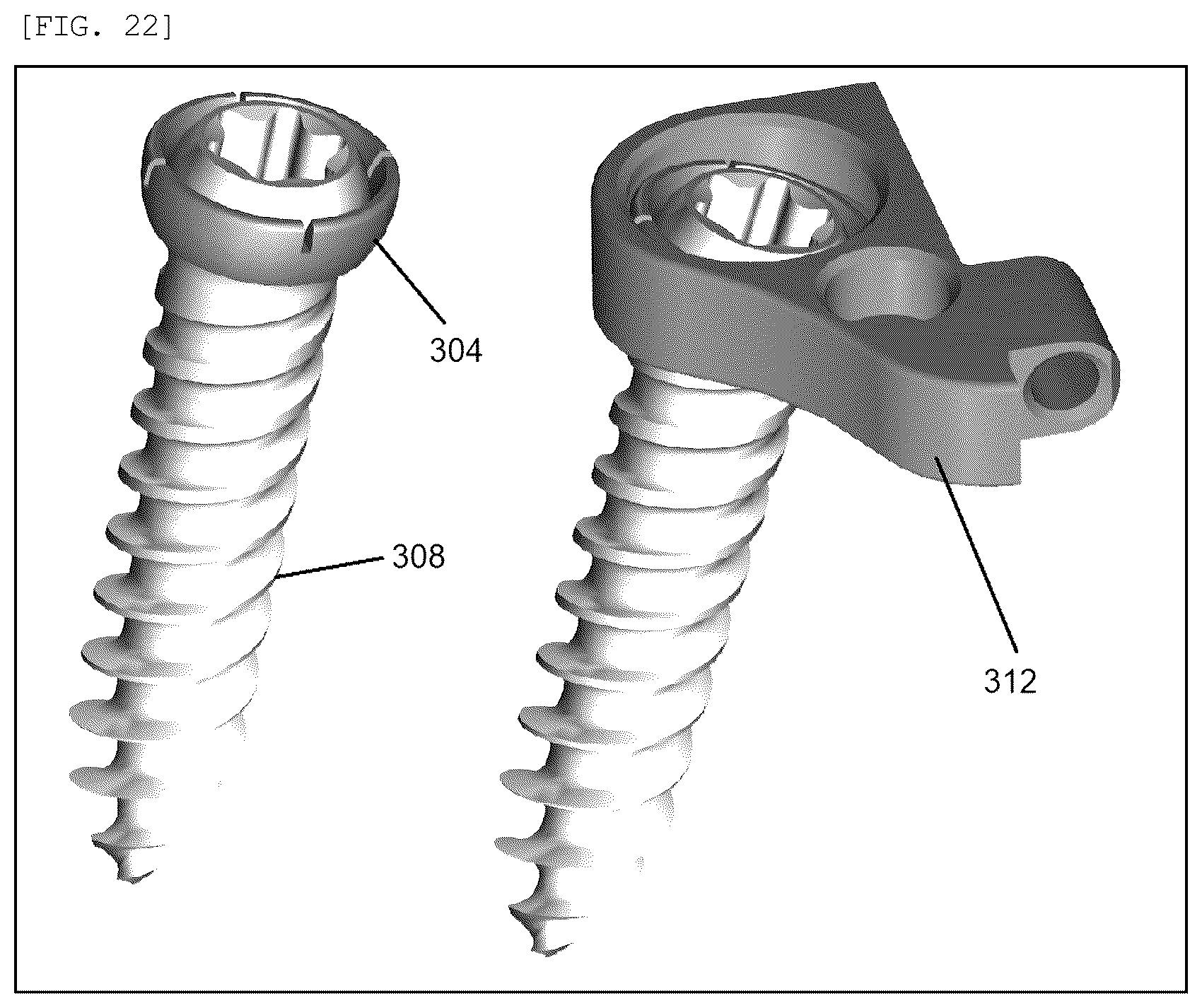 Patent US12137946 Figure 14 – Spinal plate