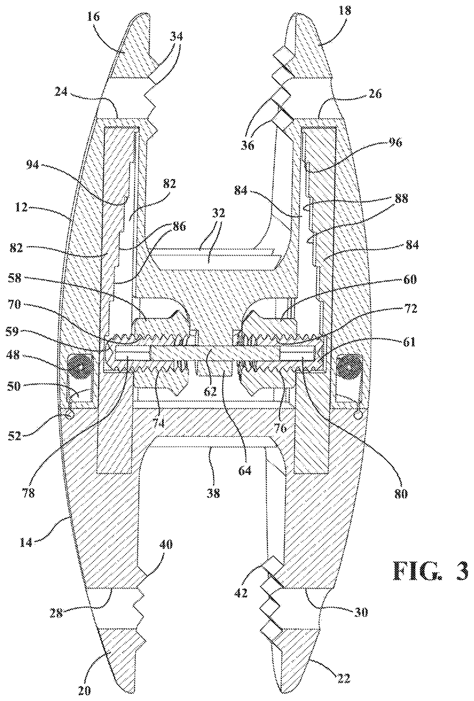 Patent US12137947 Figure 3 – Expandable spinal jack for installation between upper and lower succeeding superior articular processes