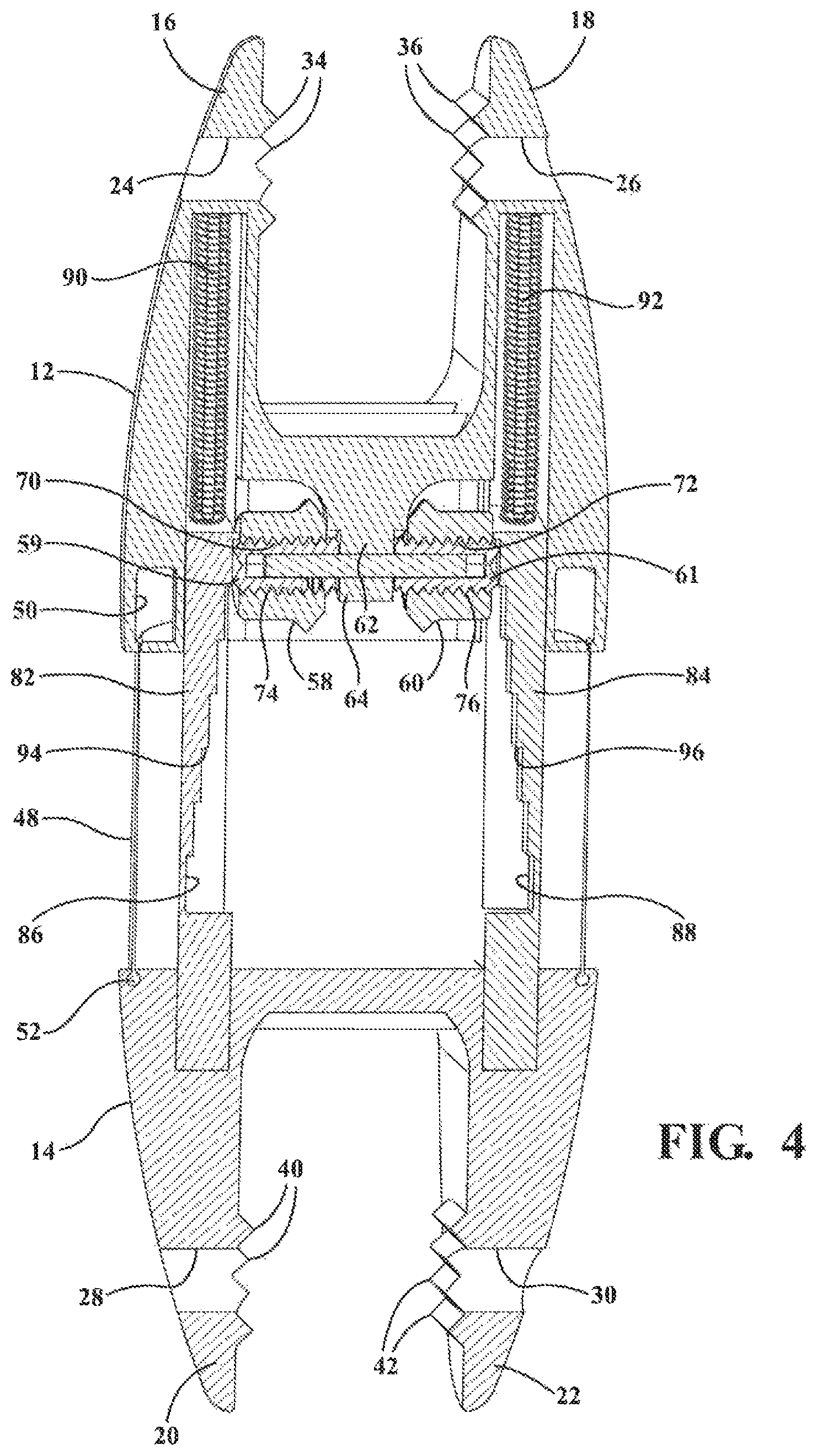 Patent US12137947 Figure 4 – Expandable spinal jack for installation between upper and lower succeeding superior articular processes