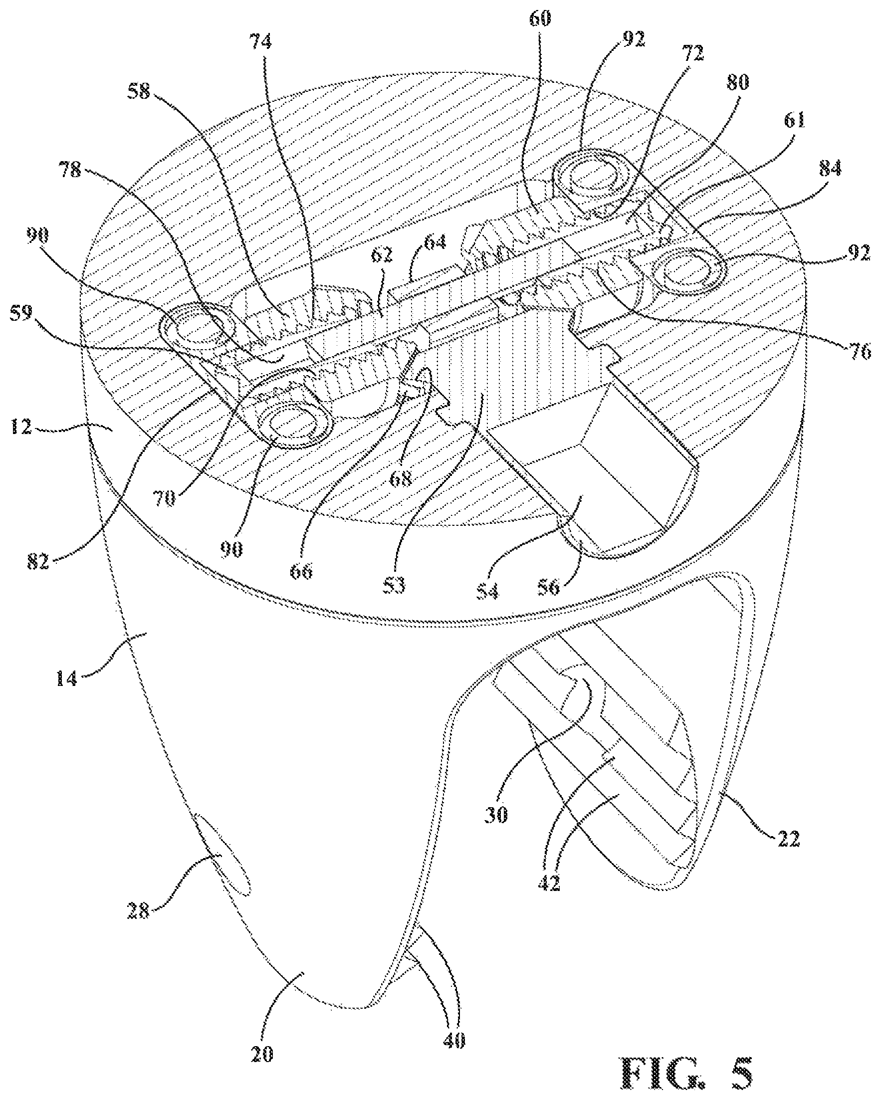 Patent US12137947 Figure 5 – Expandable spinal jack for installation between upper and lower succeeding superior articular processes