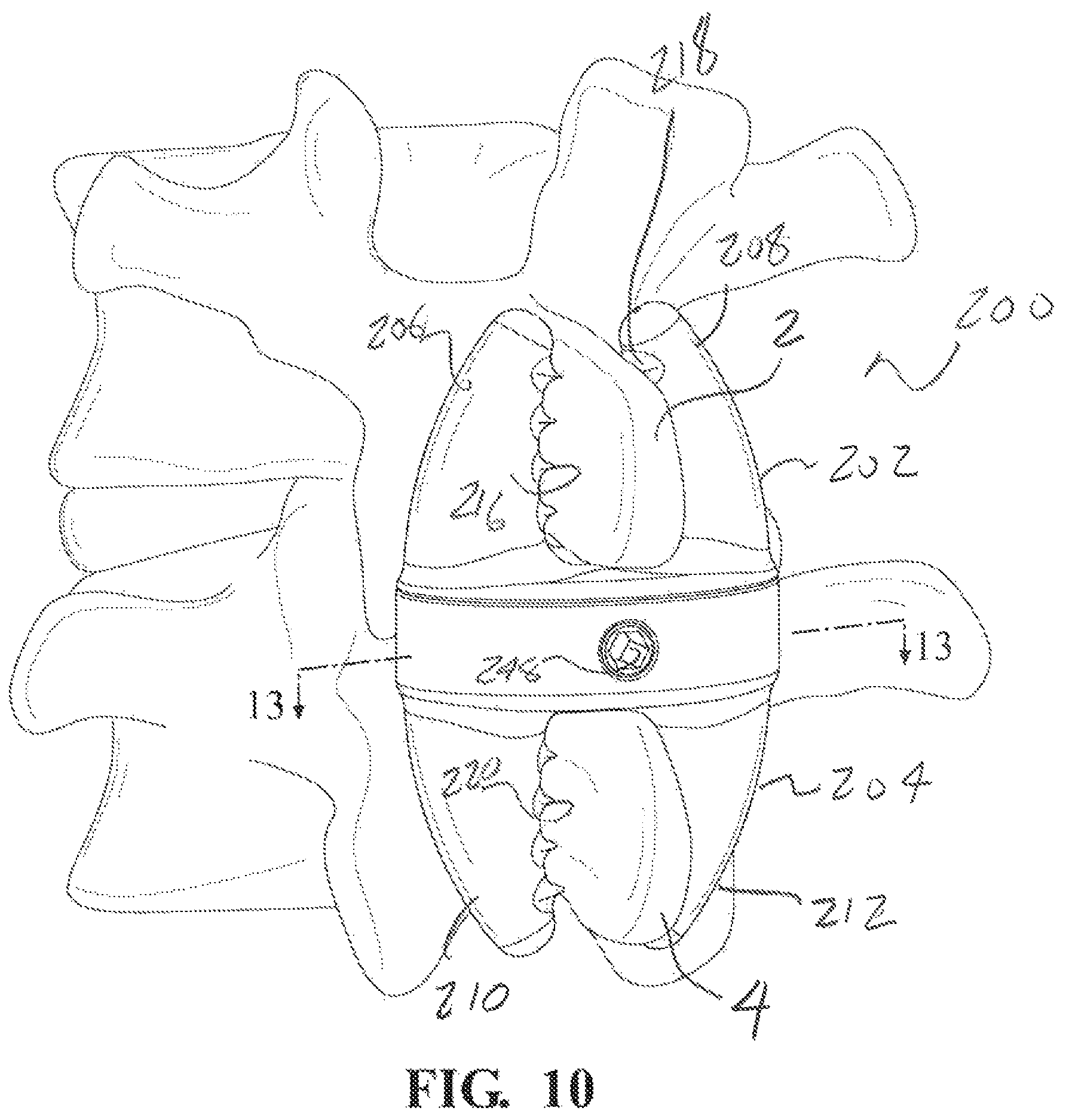 Patent US12137947 Figure 10 – Expandable spinal jack for installation between upper and lower succeeding superior articular processes