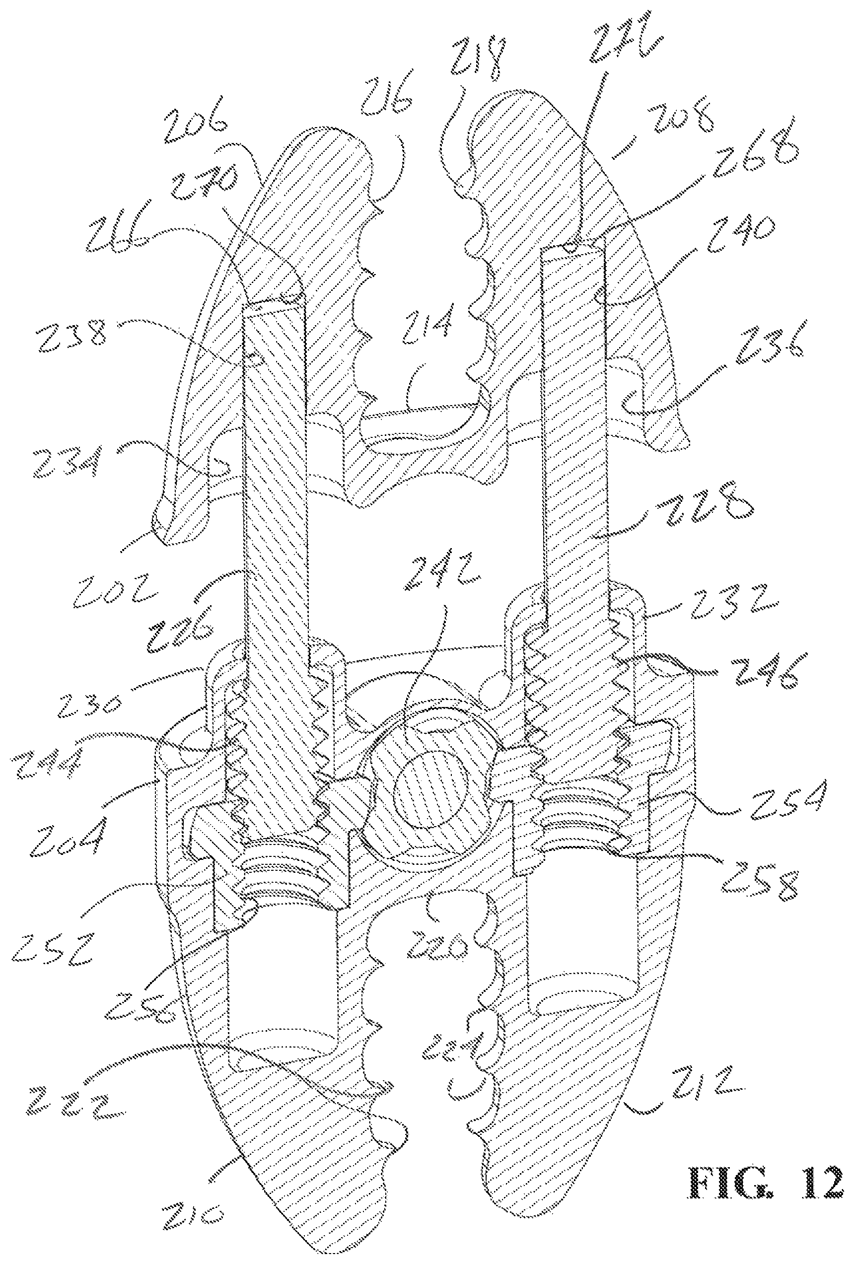 Patent US12137947 Figure 12 – Expandable spinal jack for installation between upper and lower succeeding superior articular processes