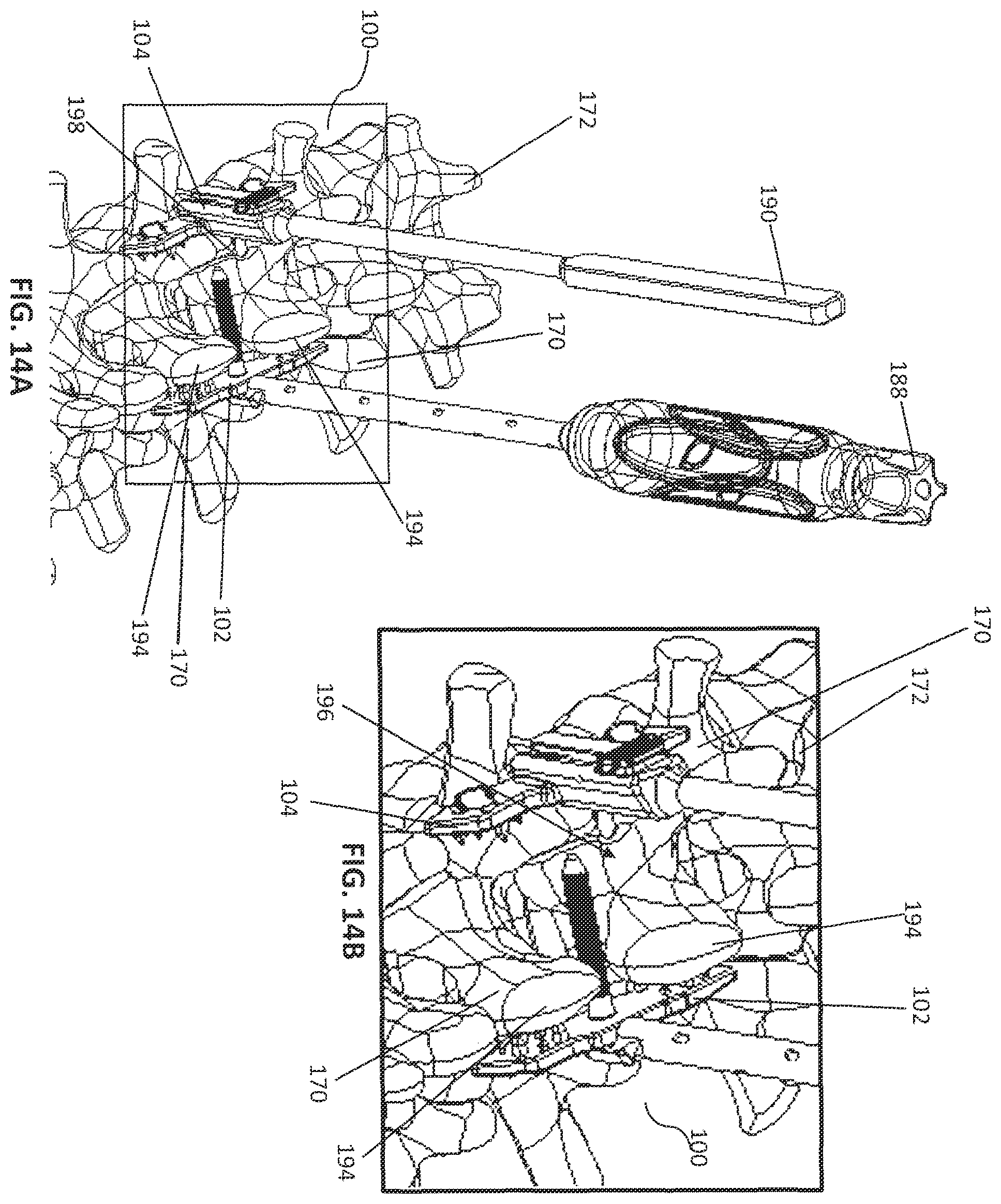 Patent US12137948 Figure 5 – Spinous process plate fixation assembly