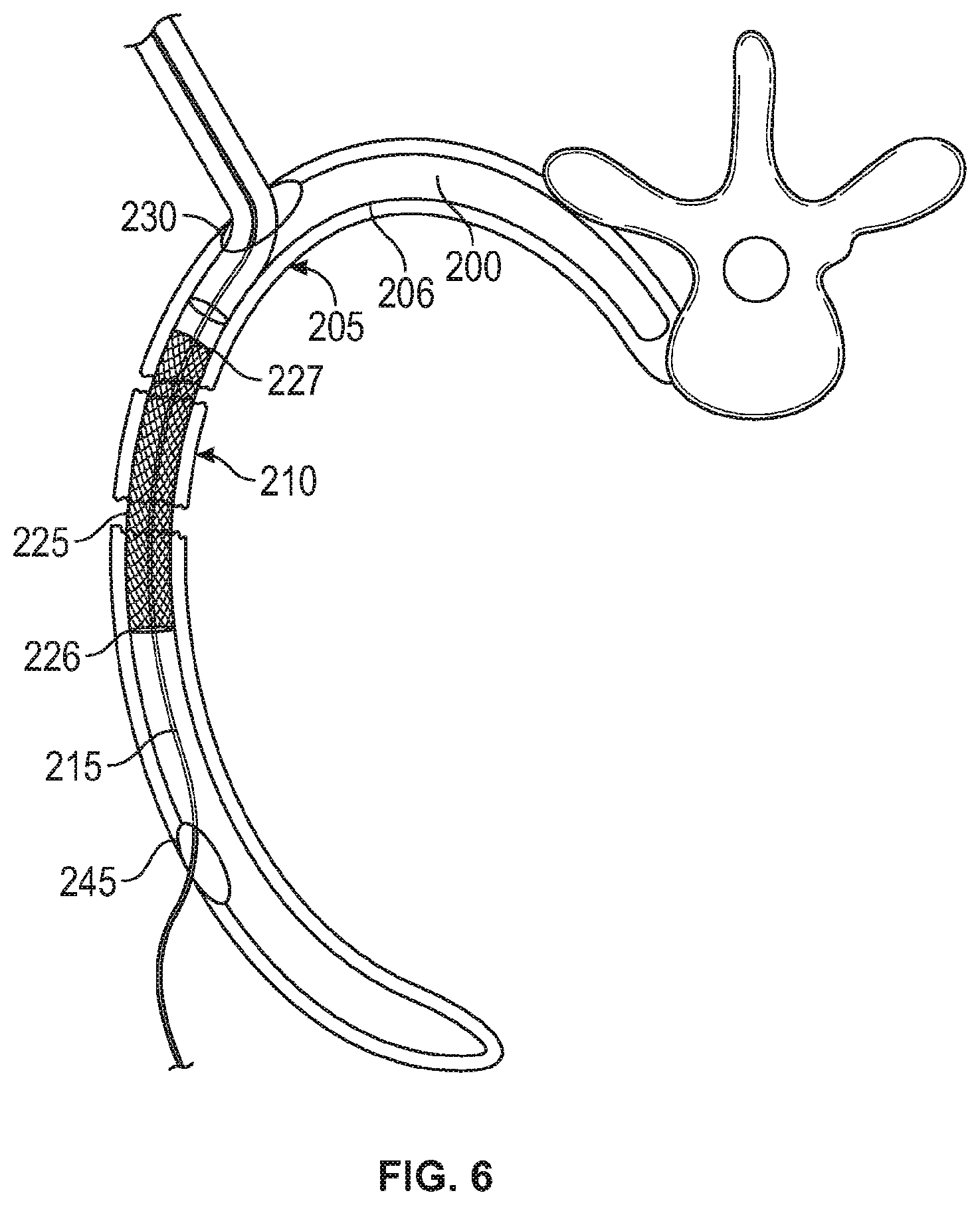Patent US12137949 Figure 3 – Rib fracture fixation device and methods for use thereof